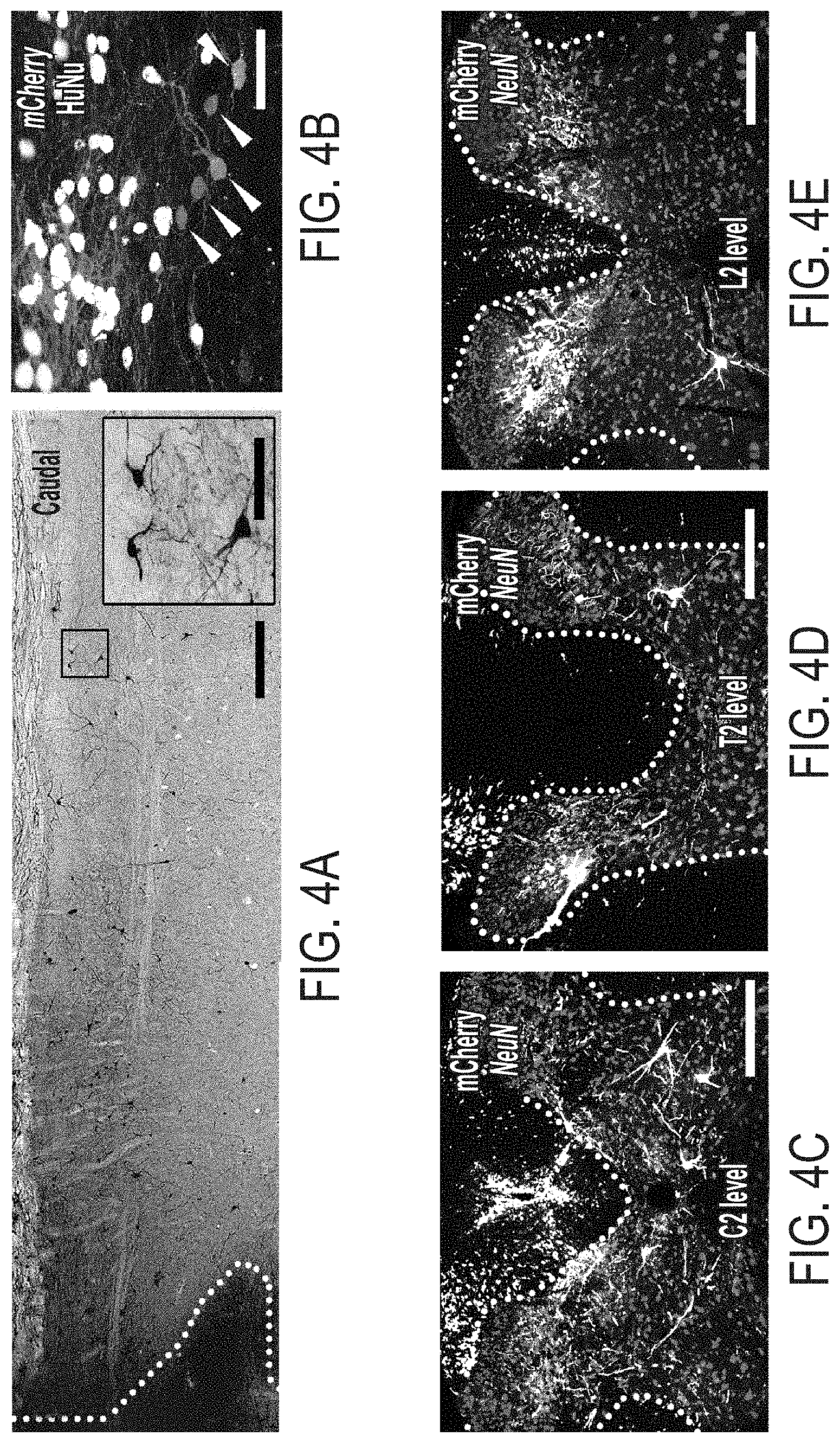 Patent US11773369 Figure 7 – Generation of human spinal cord neural stem cells