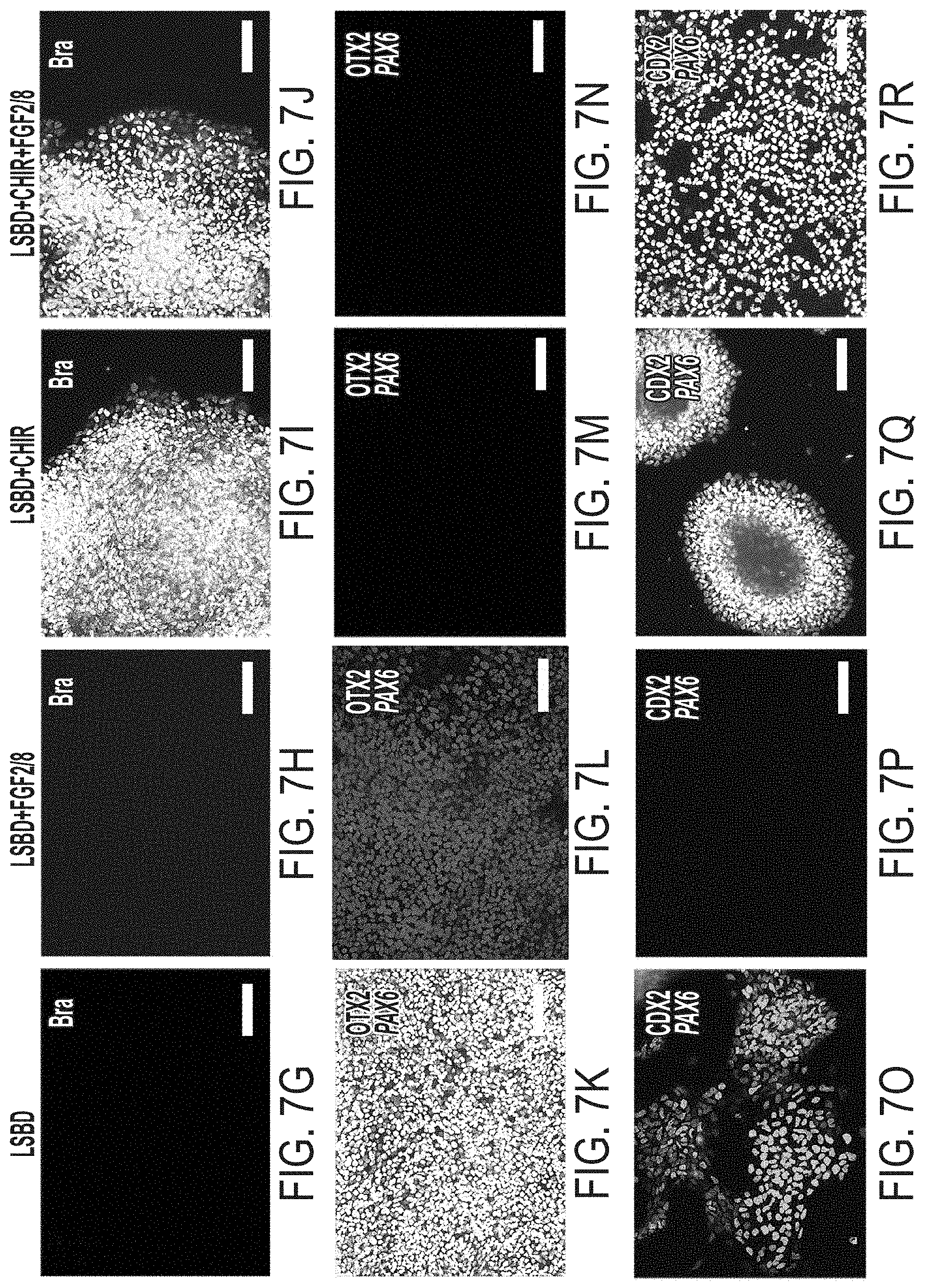 Patent US11773369 Figure 13 – Generation of human spinal cord neural stem cells