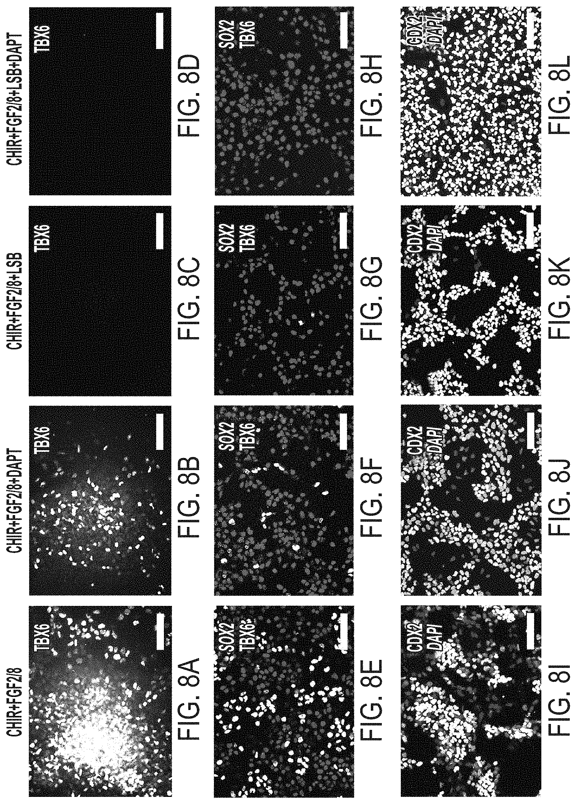 Patent US11773369 Figure 15 – Generation of human spinal cord neural stem cells