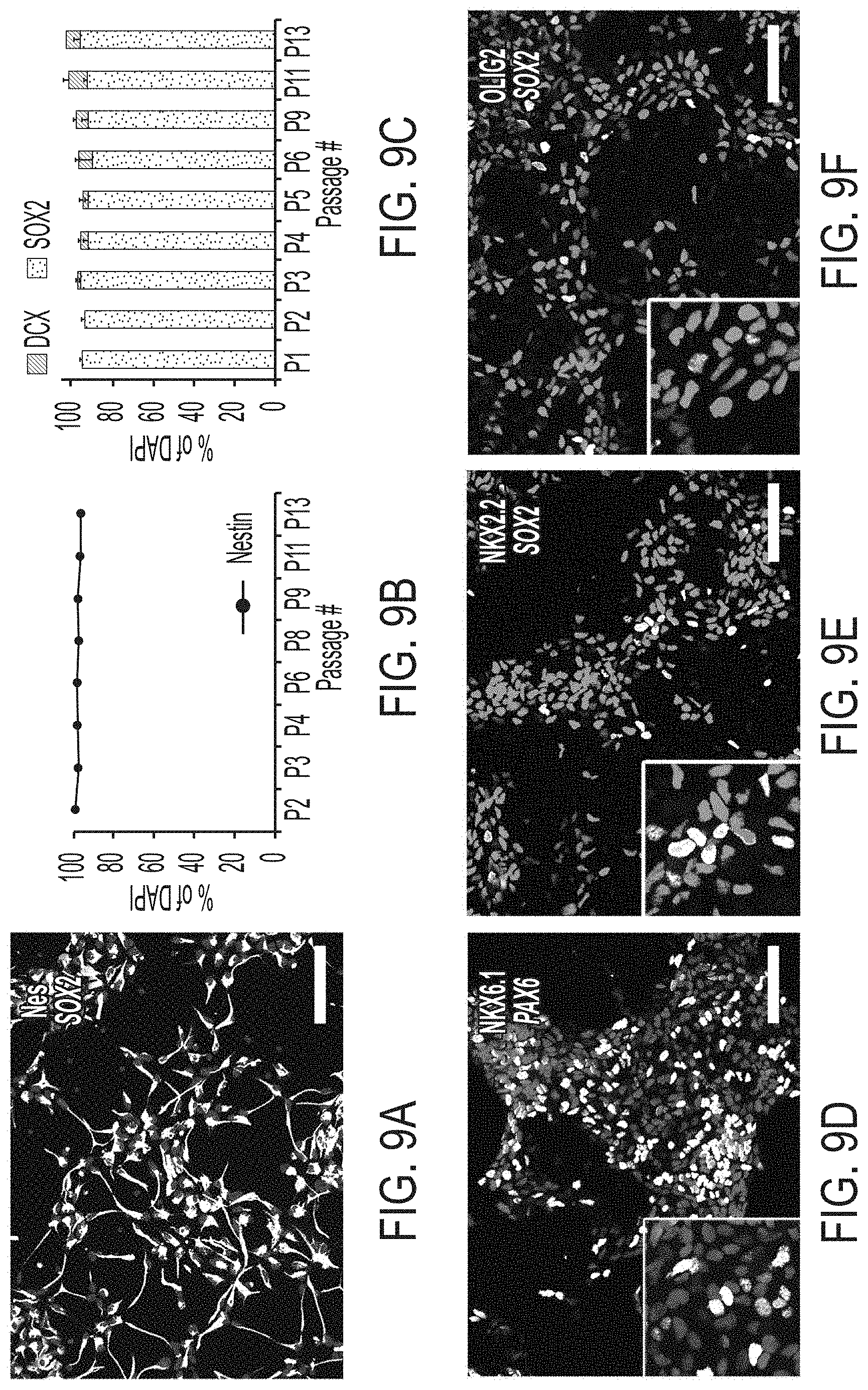 Patent US11773369 Figure 17 – Generation of human spinal cord neural stem cells