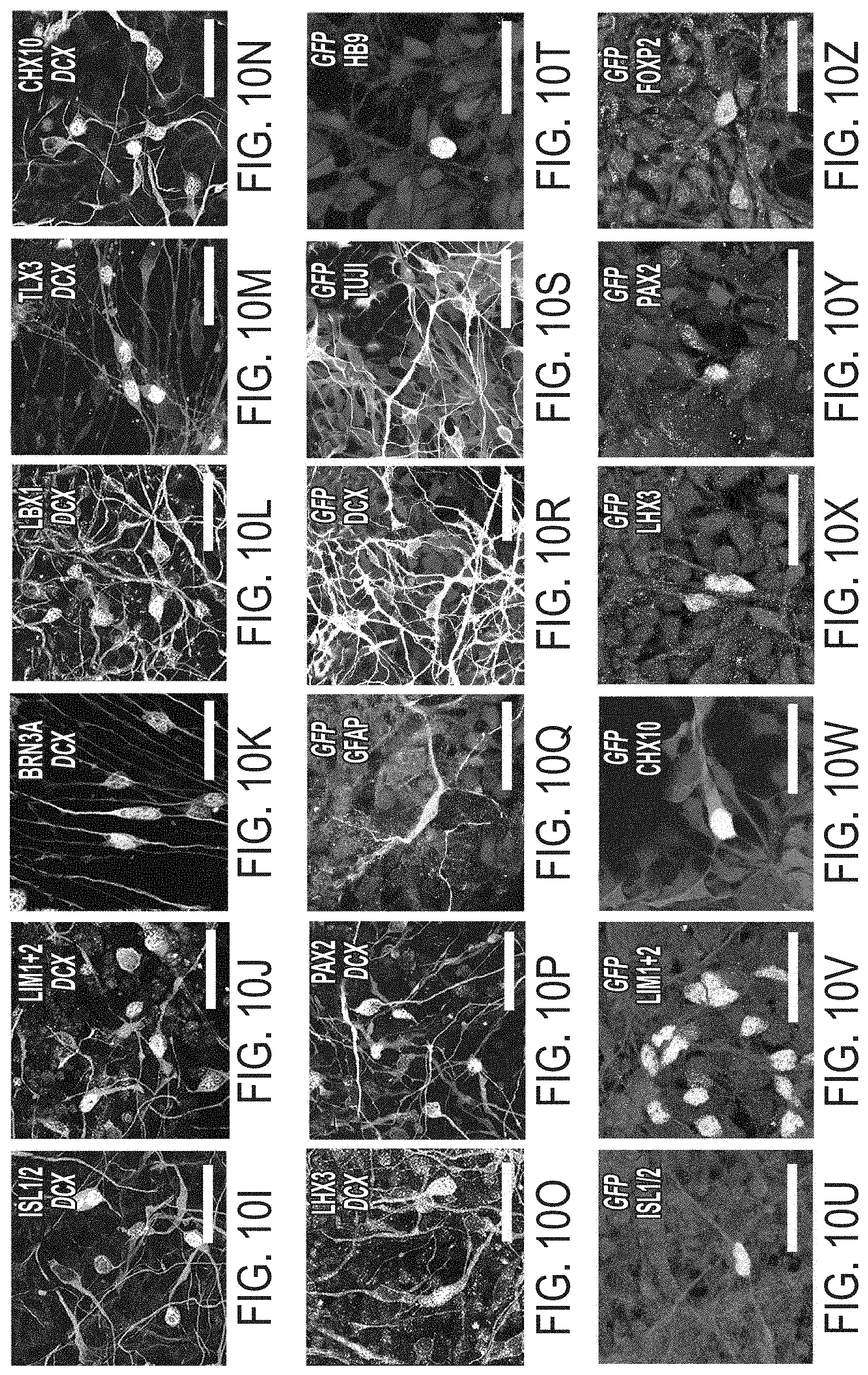Patent US11773369 Figure 20 – Generation of human spinal cord neural stem cells