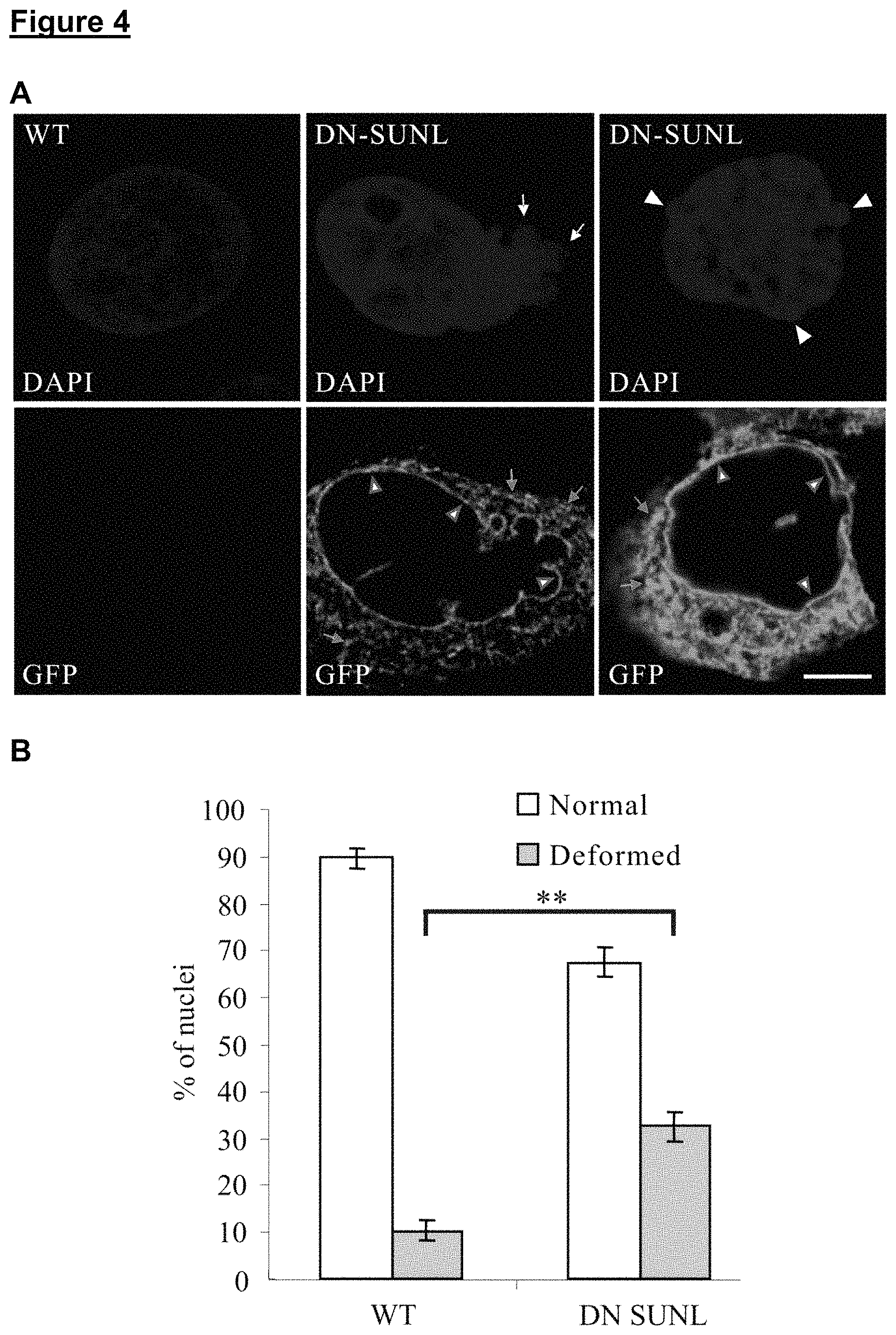Patent US11773371 Figure 4 – Skin tissue