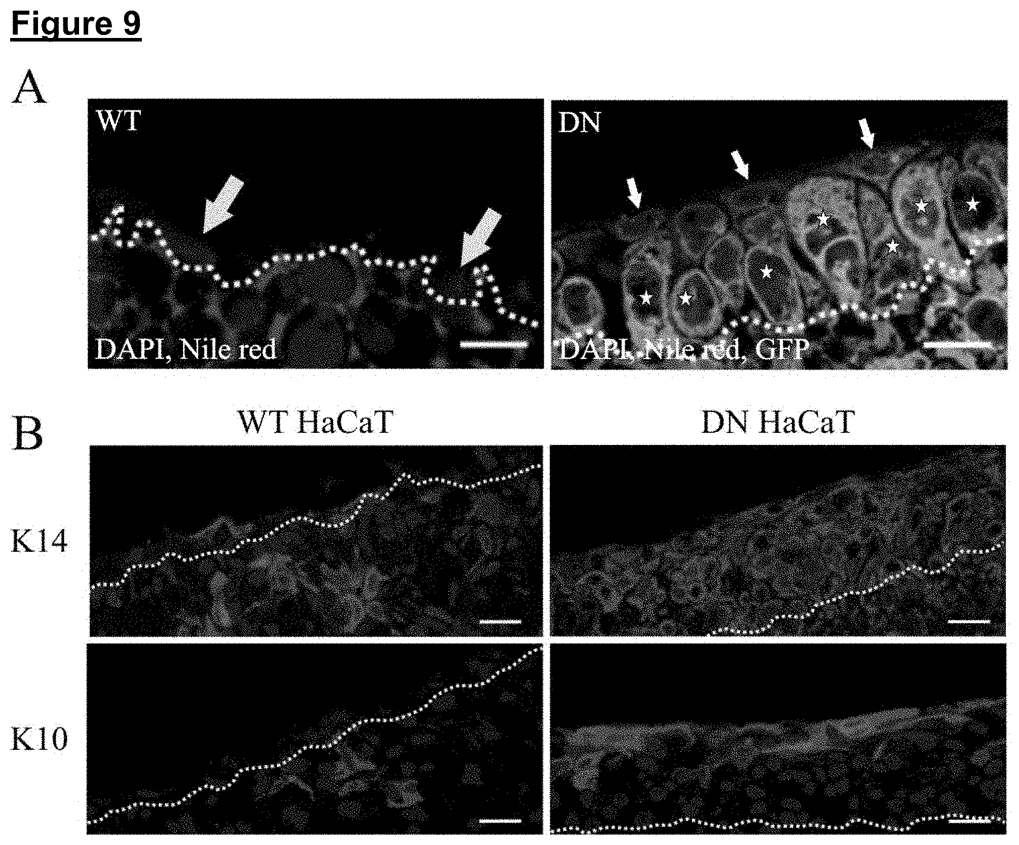 Patent US11773371 Figure 13 – Skin tissue