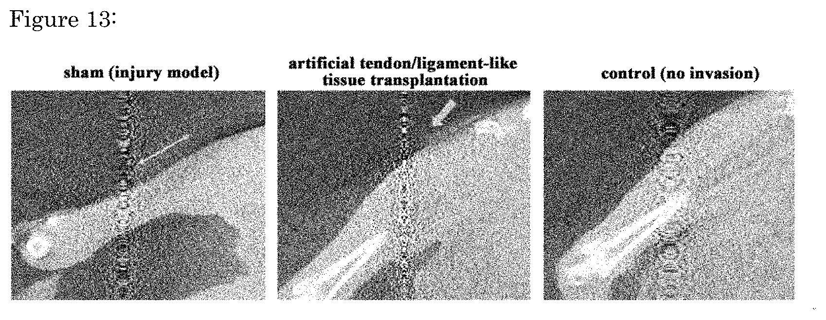 Patent US11773376 Figure 13 – Artificial tendon or ligament tissue produced using three-dimensional mechanosignaling cell culture system