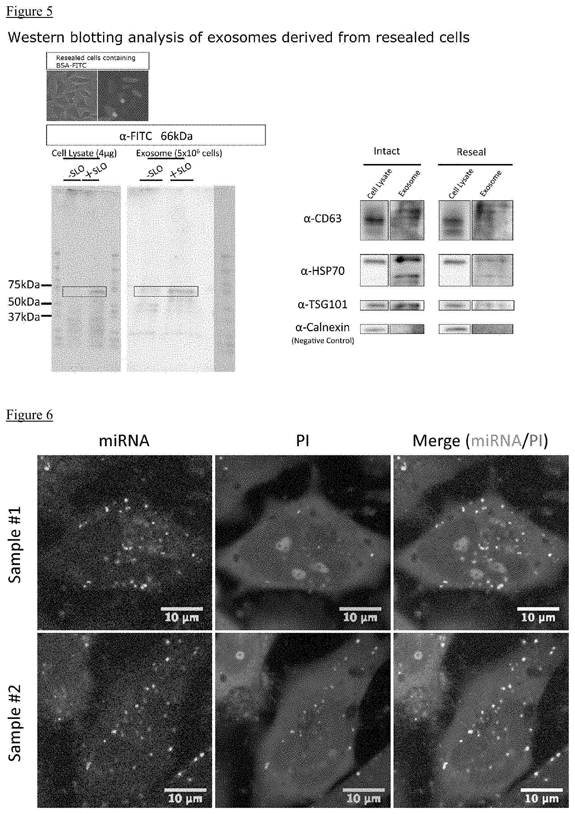 Patent US11773377 Figure 3 – Method for producing exosomes and exosomes obtained thereby