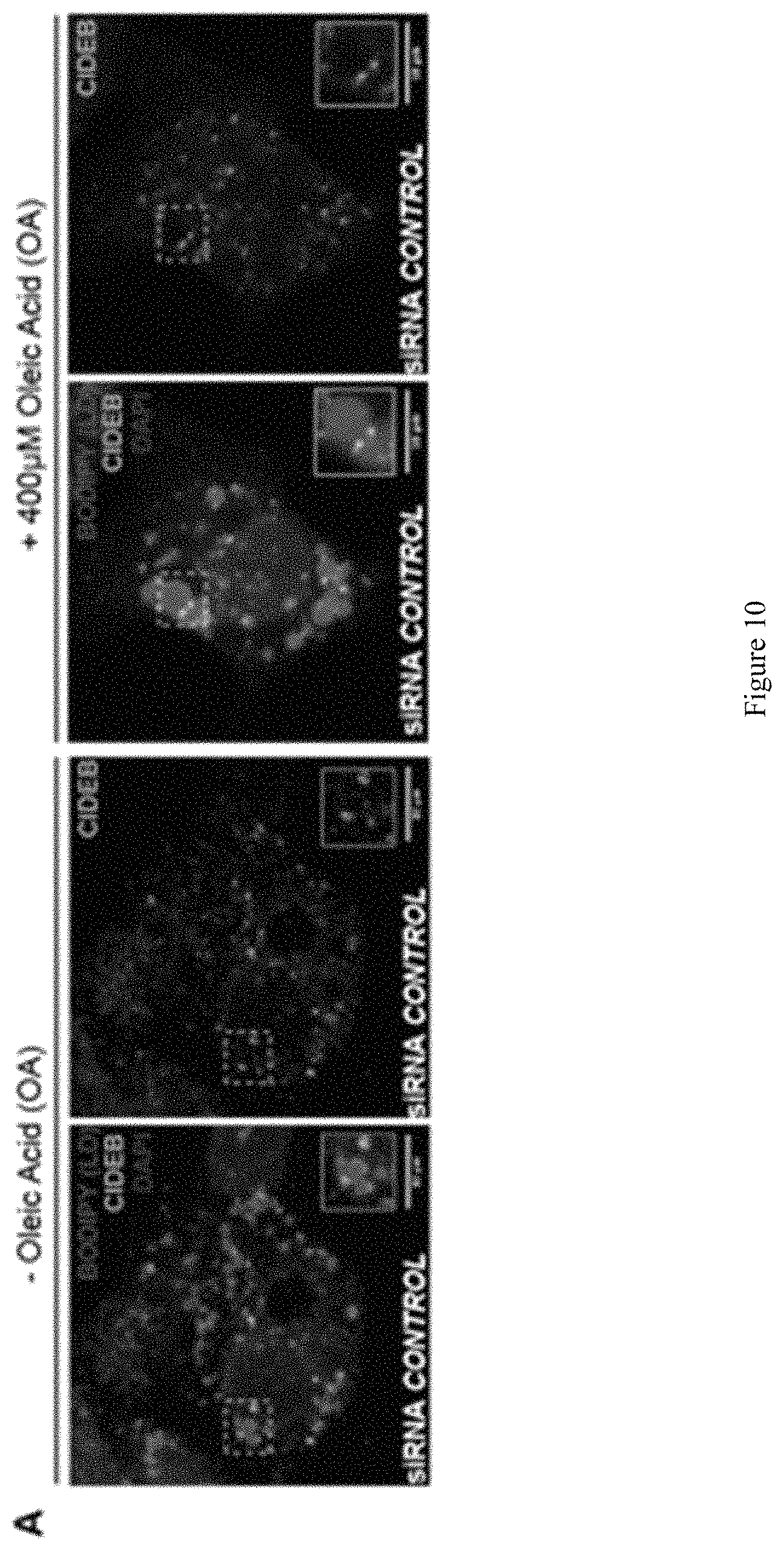 Patent US11773393 Figure 12 – Treatment of liver diseases with cell death inducing DFFA like effector B (CIDEB) inhibitors