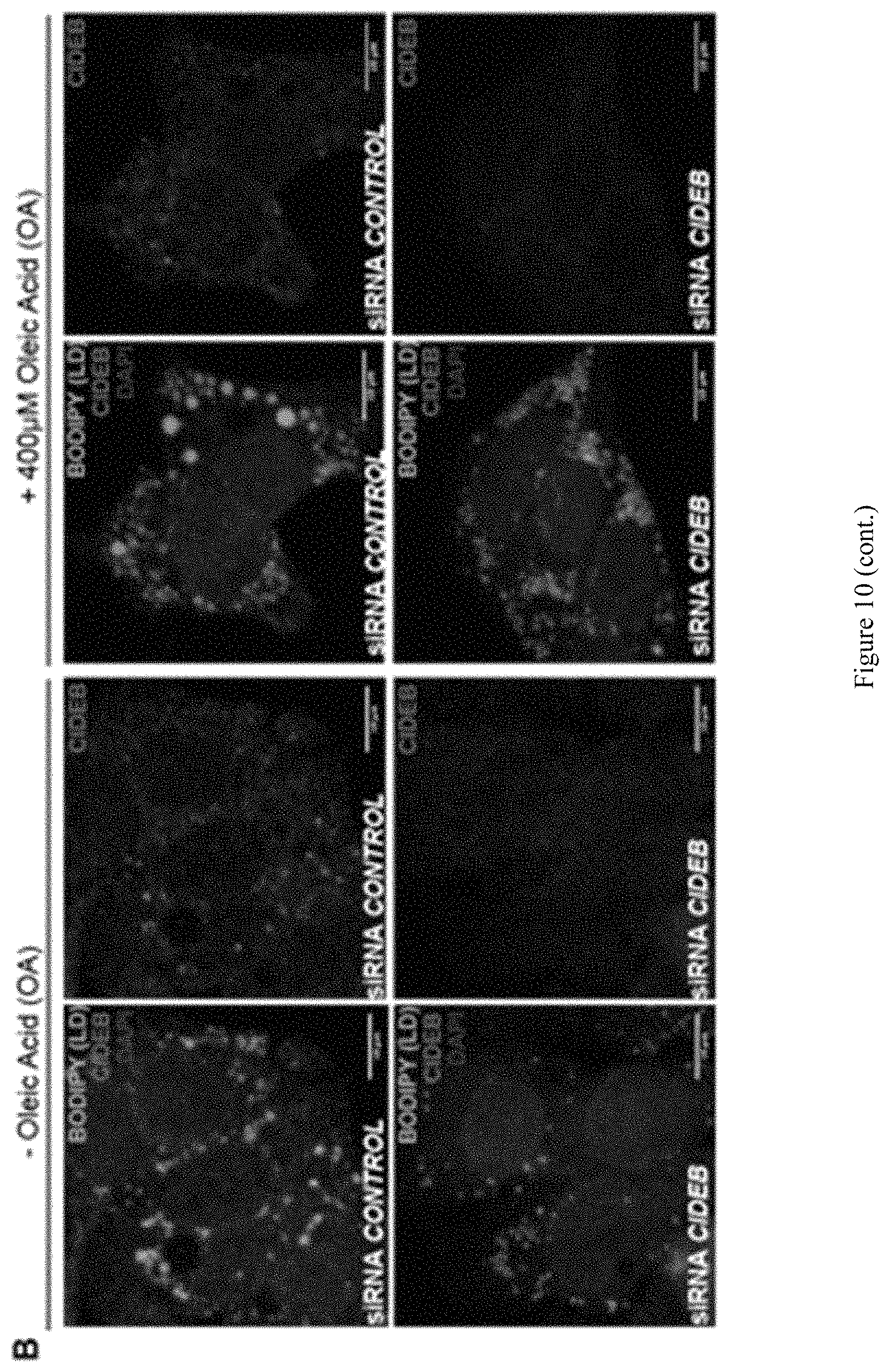 Patent US11773393 Figure 13 – Treatment of liver diseases with cell death inducing DFFA like effector B (CIDEB) inhibitors