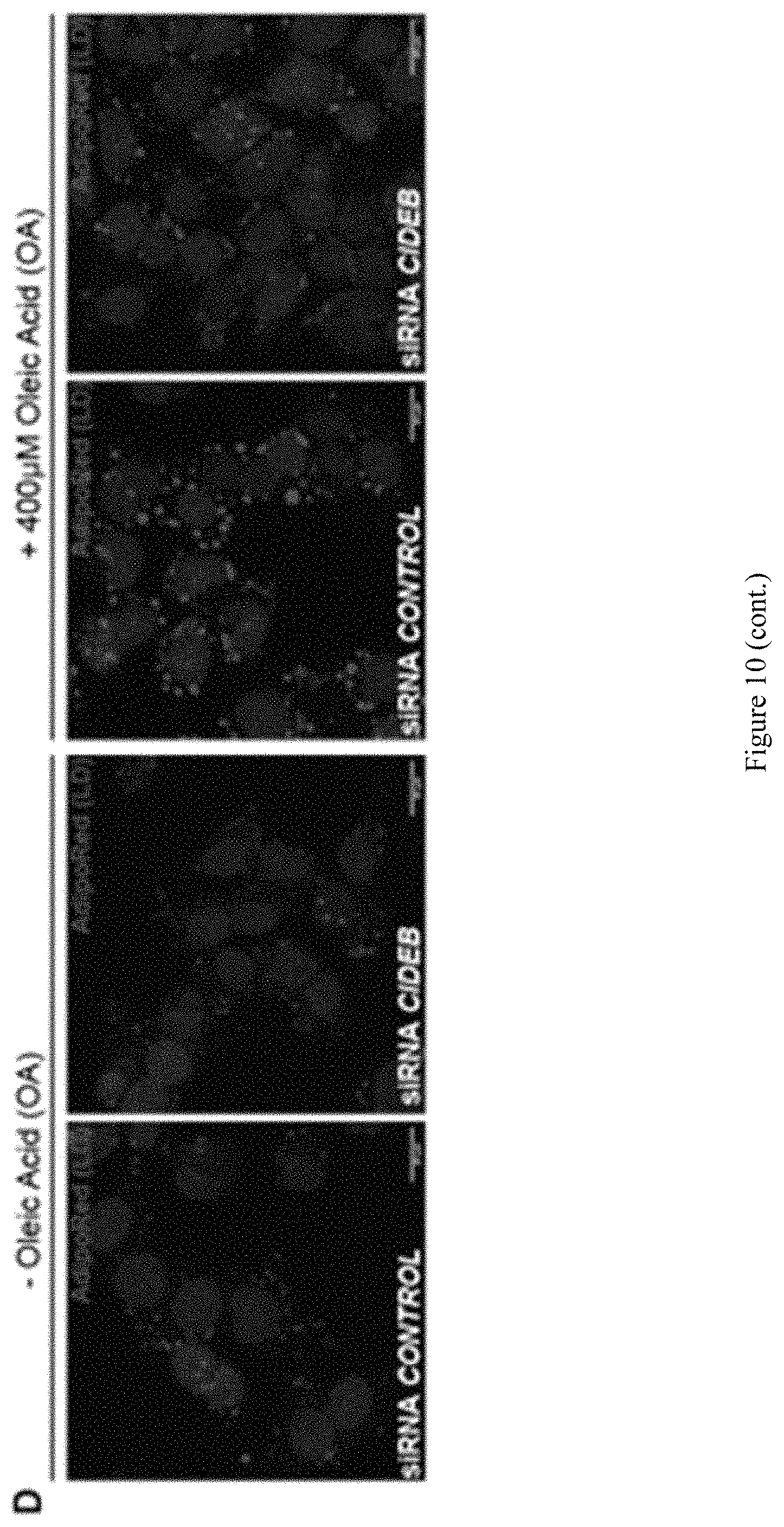 Patent US11773393 Figure 15 – Treatment of liver diseases with cell death inducing DFFA like effector B (CIDEB) inhibitors