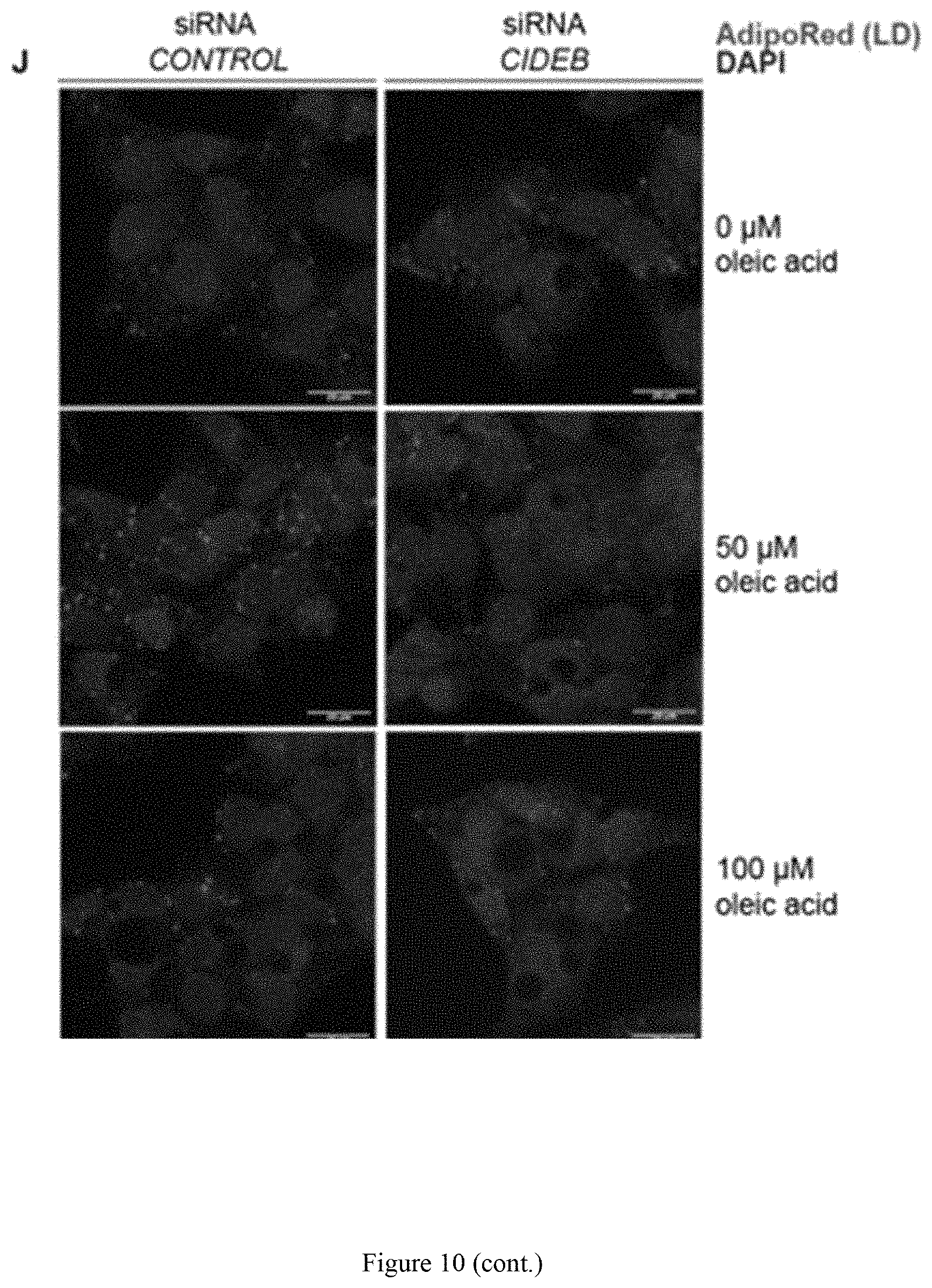 Patent US11773393 Figure 18 – Treatment of liver diseases with cell death inducing DFFA like effector B (CIDEB) inhibitors