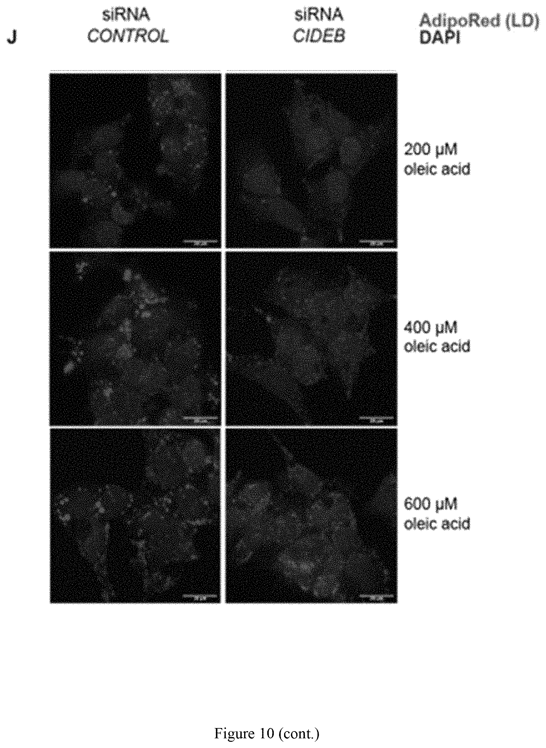 Patent US11773393 Figure 19 – Treatment of liver diseases with cell death inducing DFFA like effector B (CIDEB) inhibitors