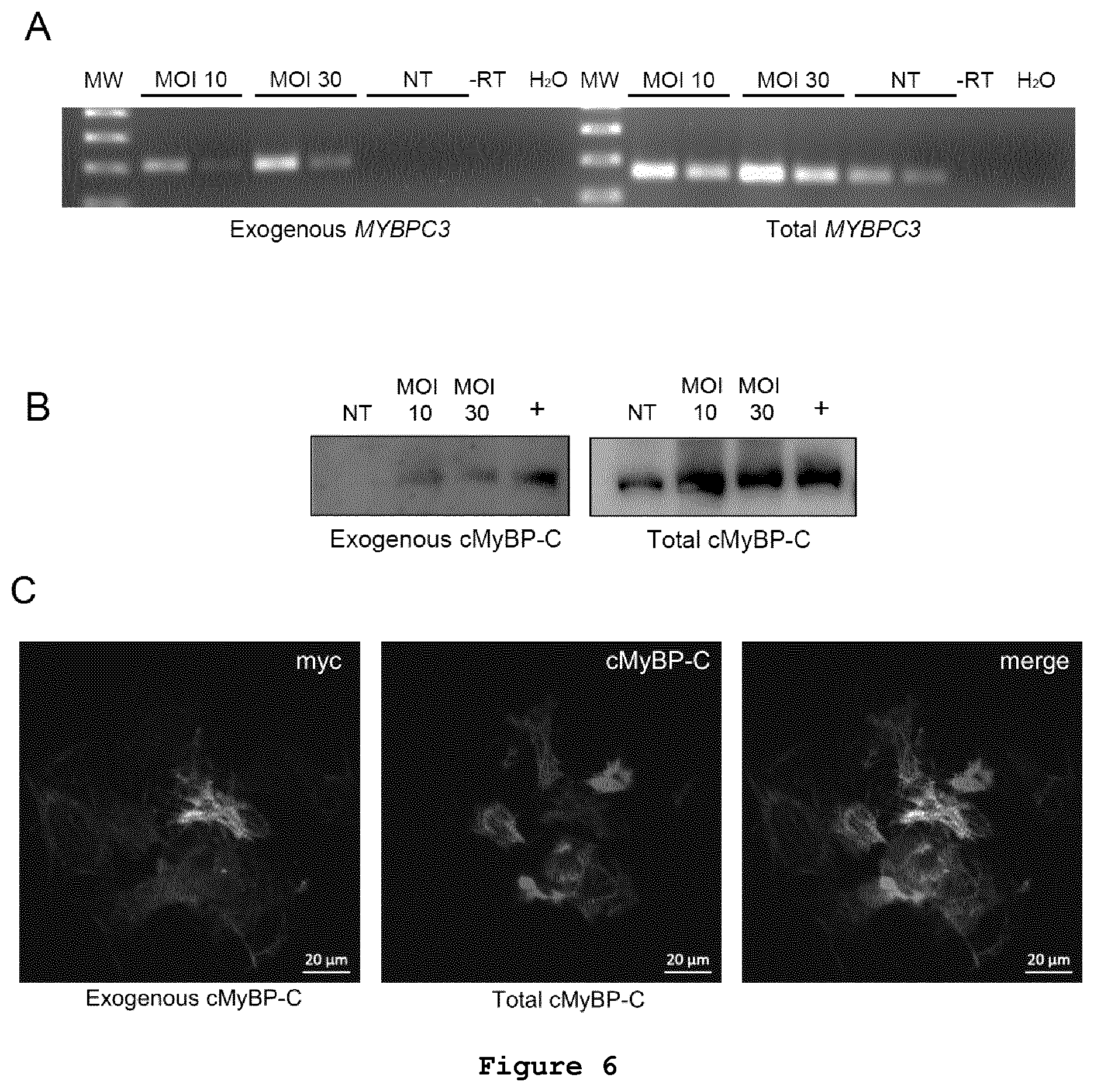 Patent US11773408 Figure 6 – Gene-therapy vectors for treating cardiomyopathy