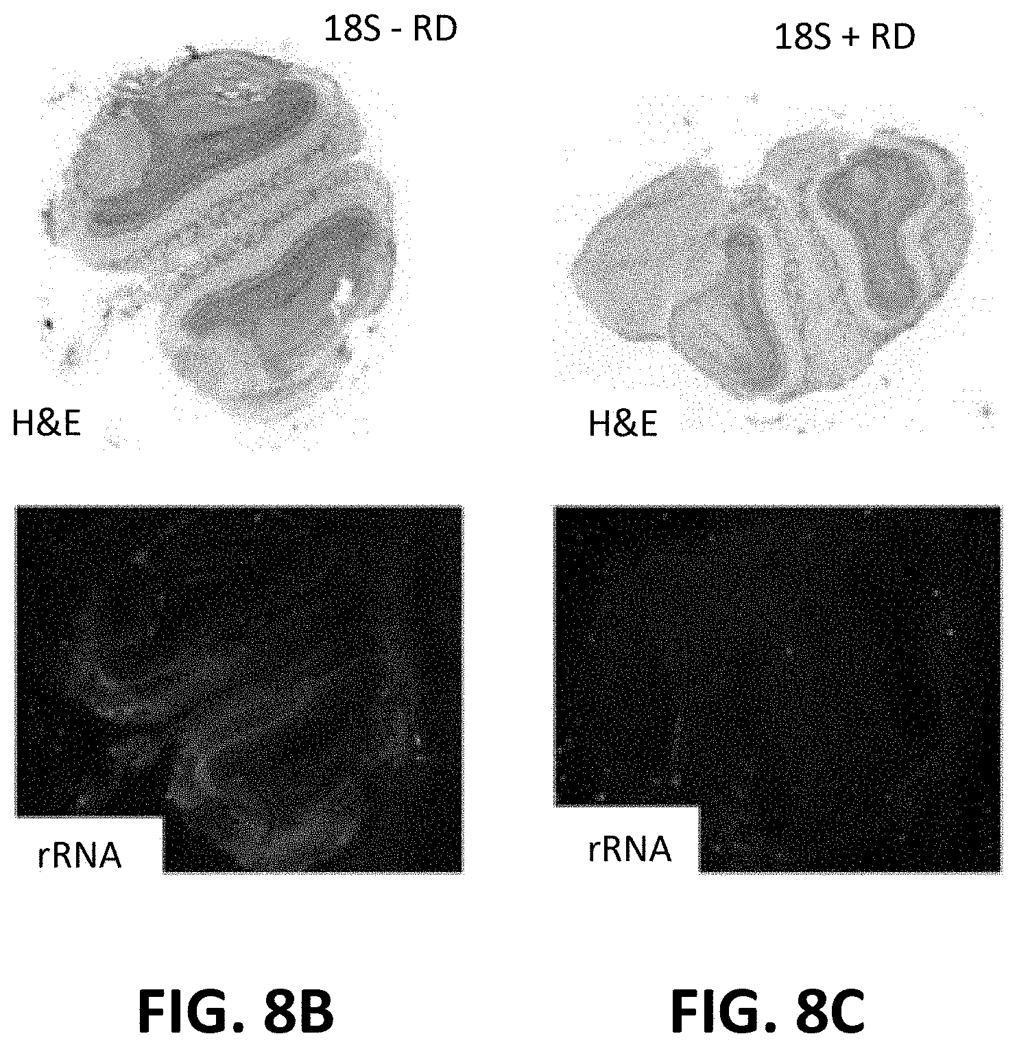 Patent US11773433 Figure 11 – Methods for spatial analysis using targeted RNA depletion