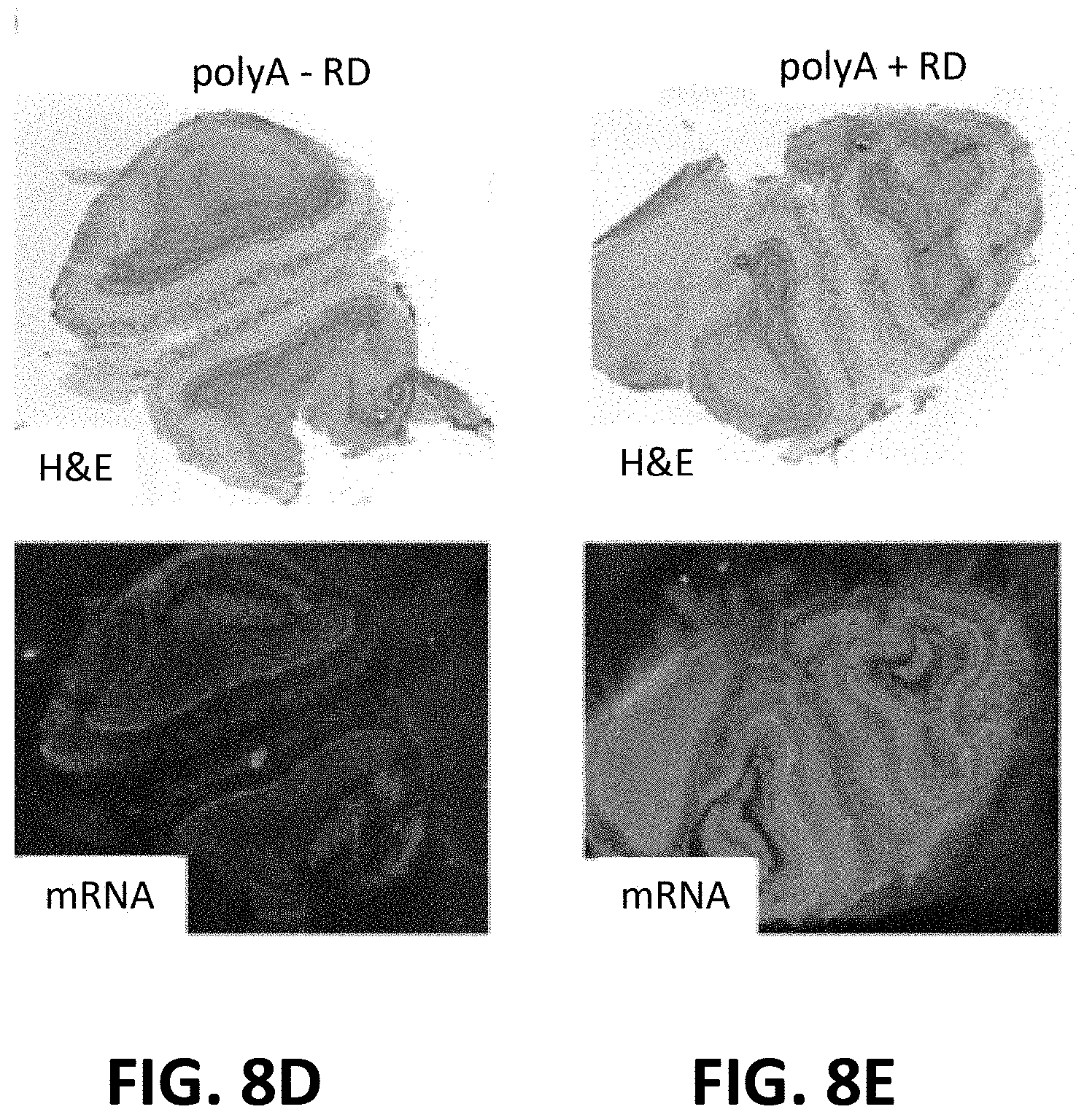 Patent US11773433 Figure 12 – Methods for spatial analysis using targeted RNA depletion