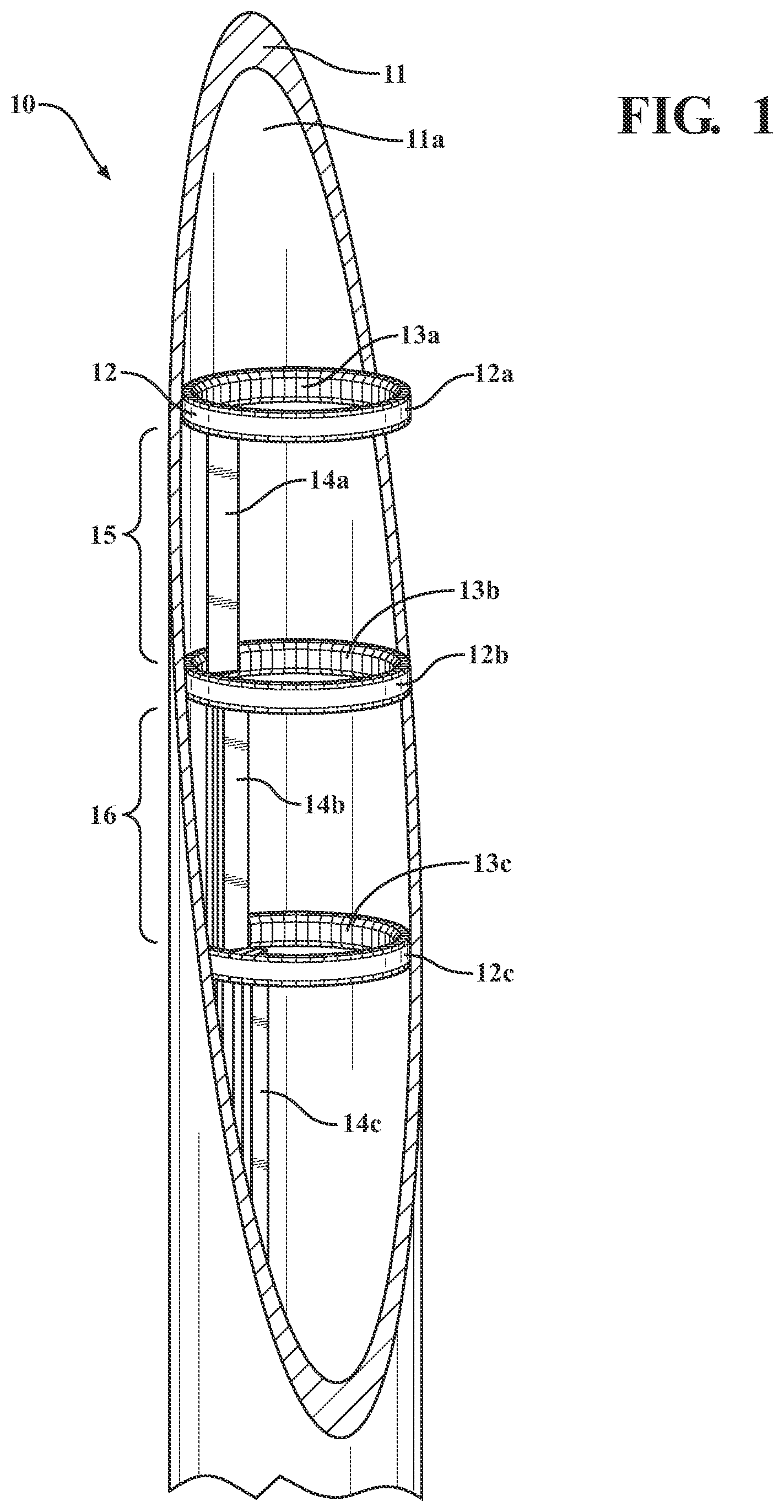Patent US11773495 — Vitreous coating application by induction heating and integration with induction kinetic weld joining — Figure 1