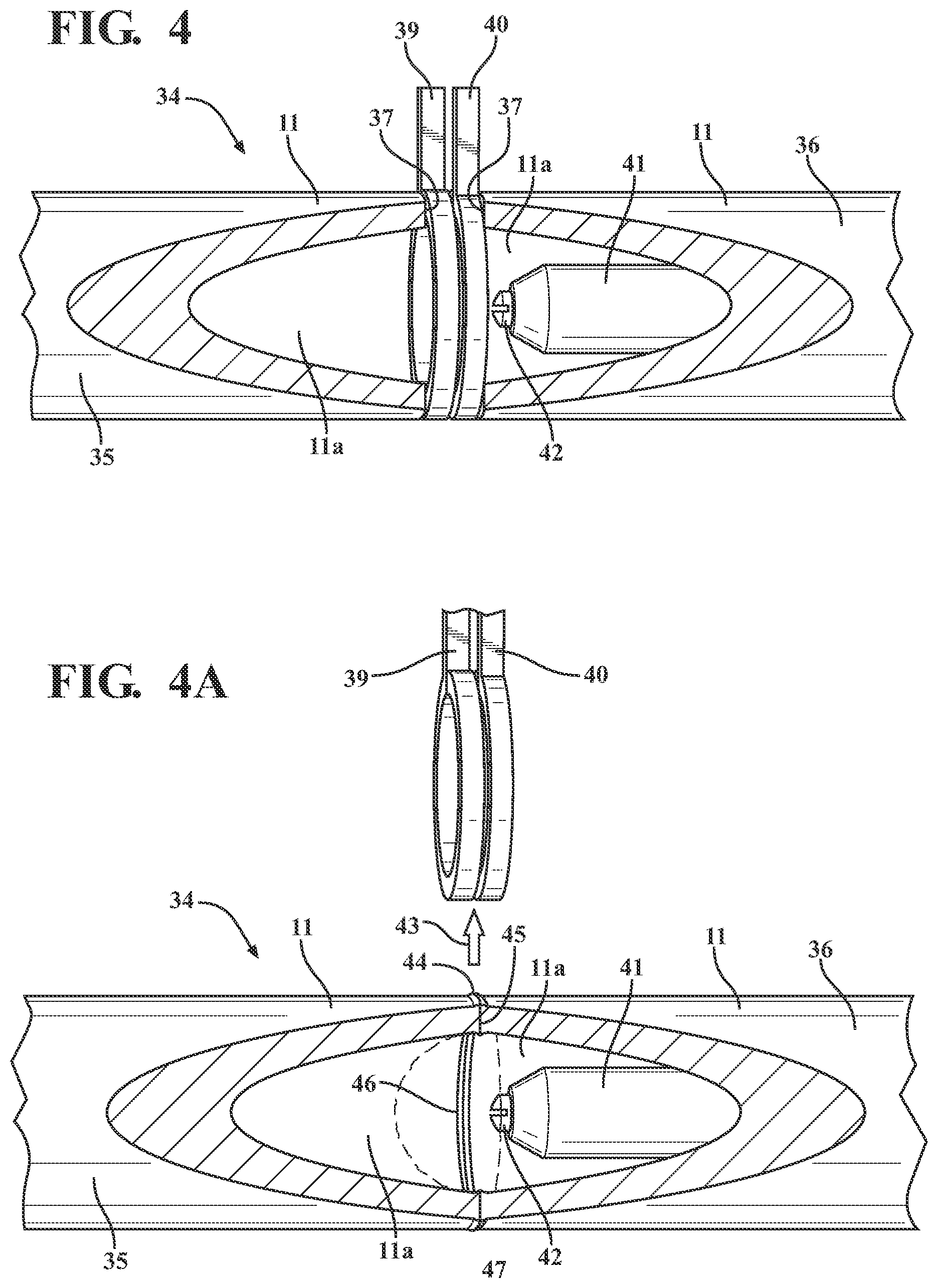 Patent US11773495 Figure 4 – Vitreous coating application by induction heating and integration with induction kinetic weld joining