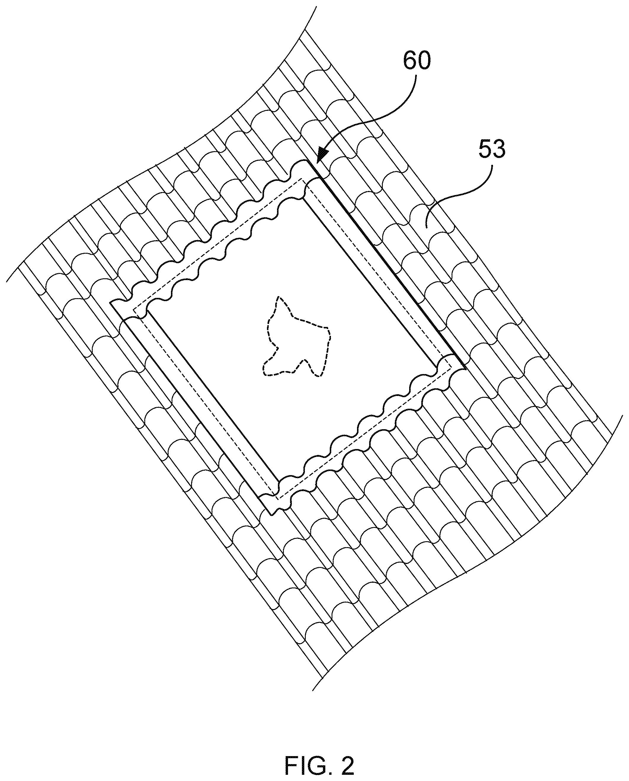 Patent US11773611 Figure 2 – Protective roof tarp and associated methods