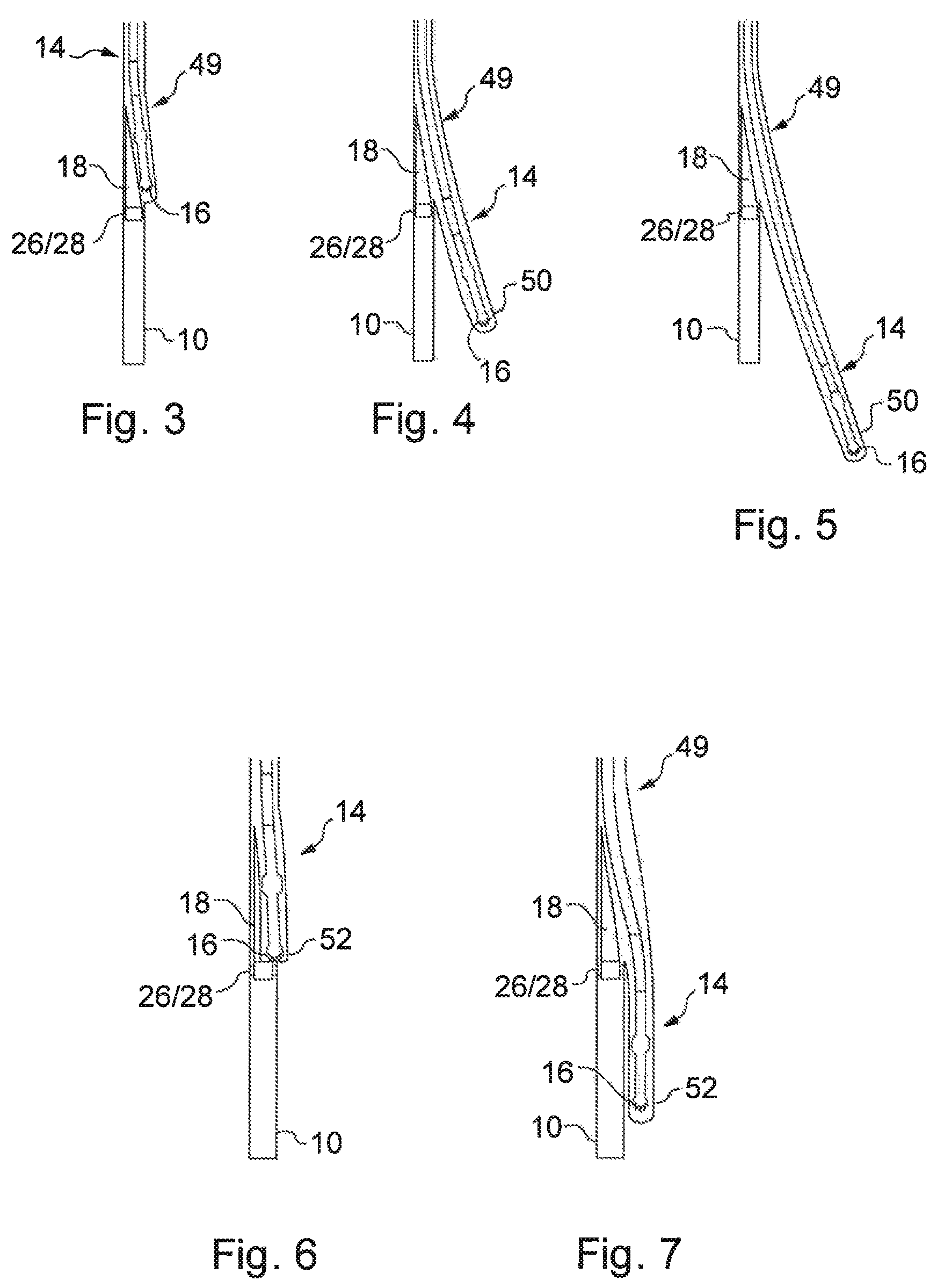 Patent US11773676 Figure 3 – Whipstock assembly