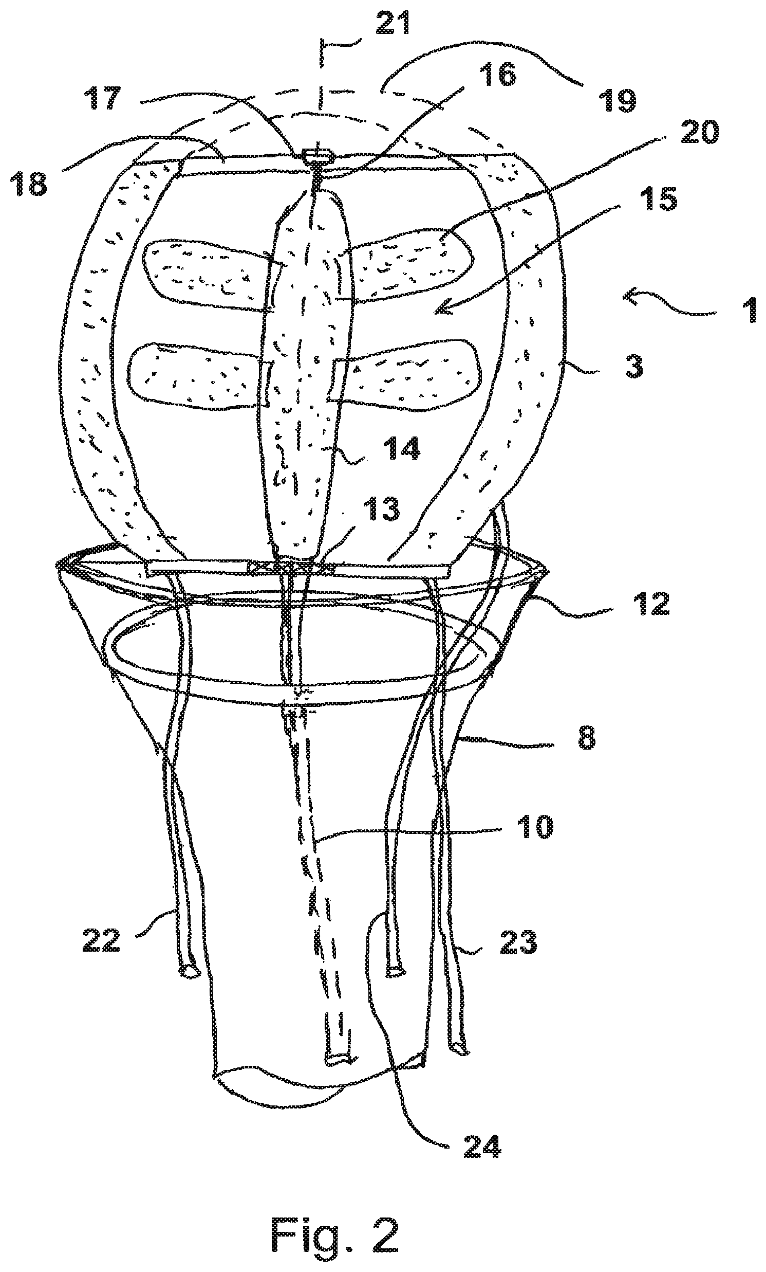 Patent US11773861 Figure 2 – Compressible rotor for a fluid pump