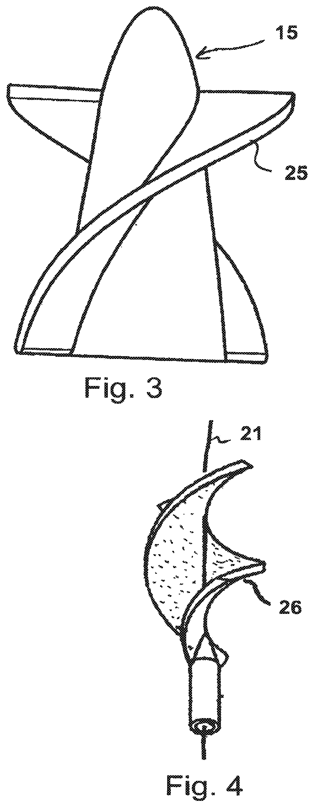 Patent US11773861 Figure 3 – Compressible rotor for a fluid pump