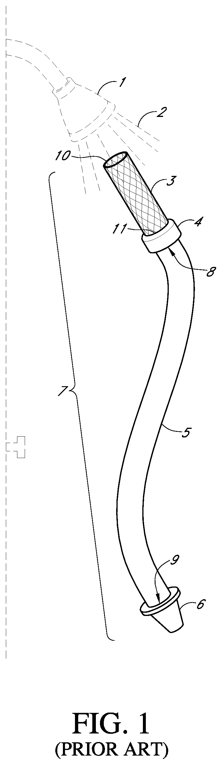 Patent US11774021 Figure 1 – Connector assembly and methods of use