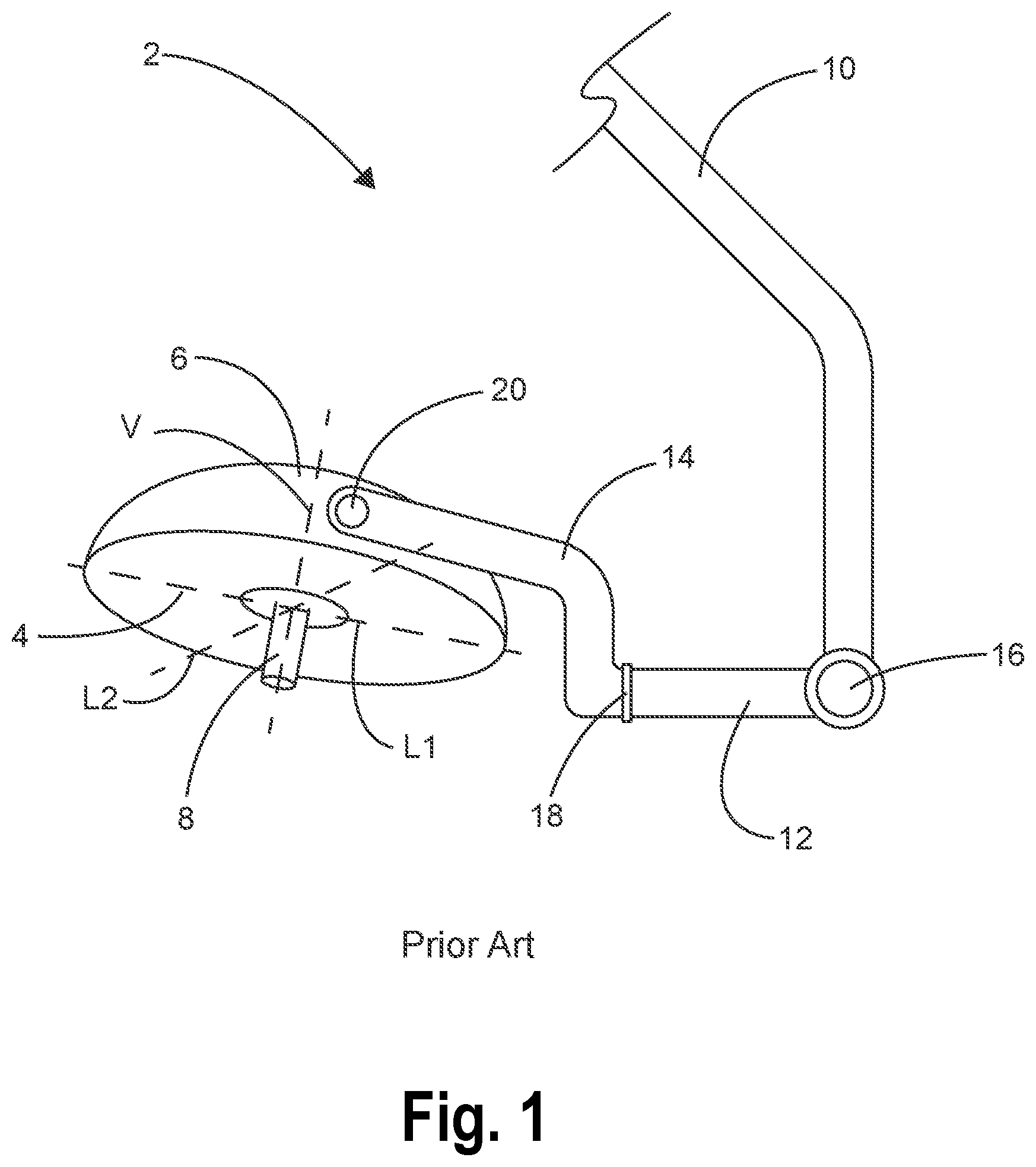 Patent US11774076 — Aerodynamic surgical light and boom systems — Figure 1
