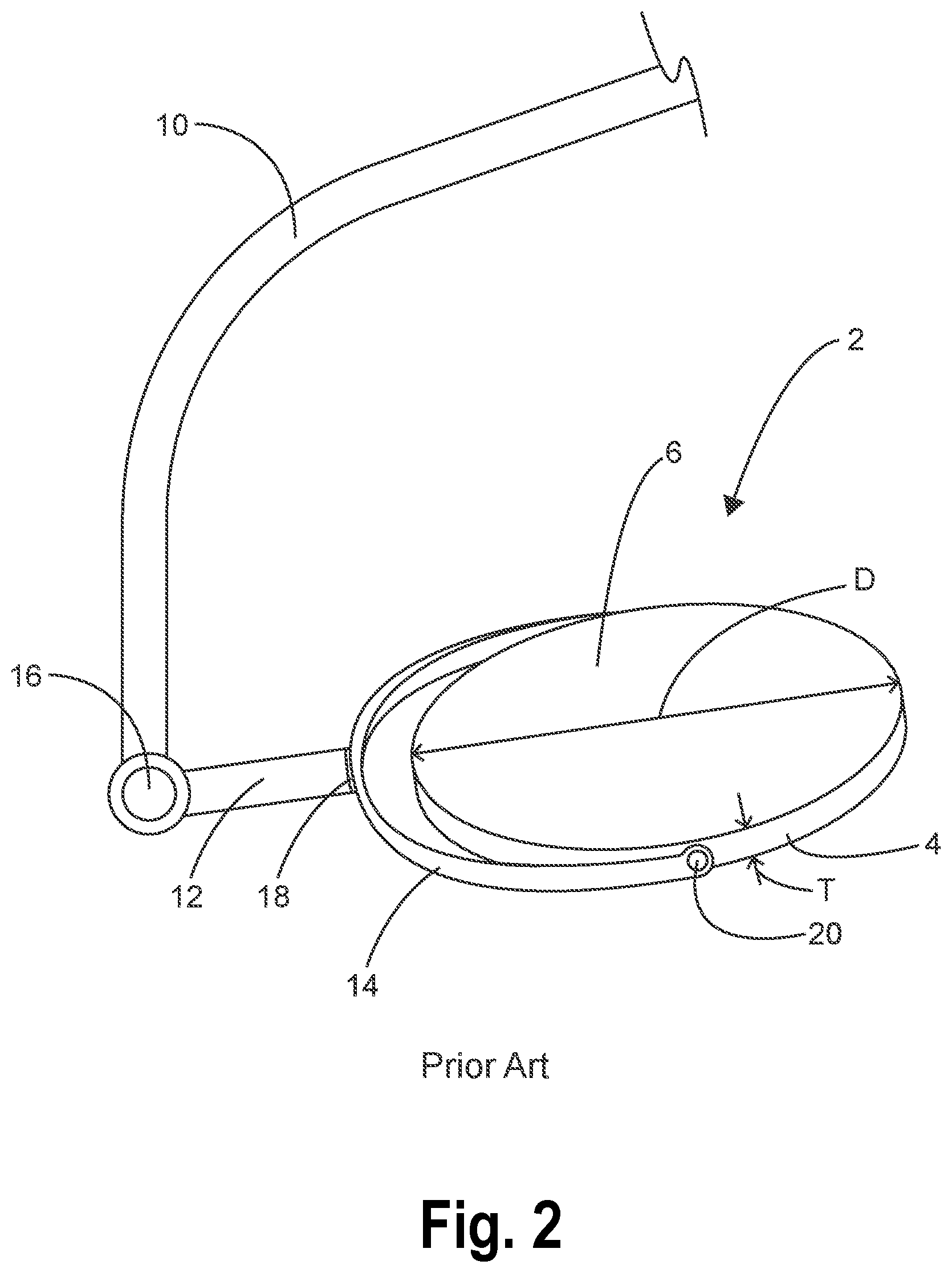 Patent US11774076 Figure 2 – Aerodynamic surgical light and boom systems