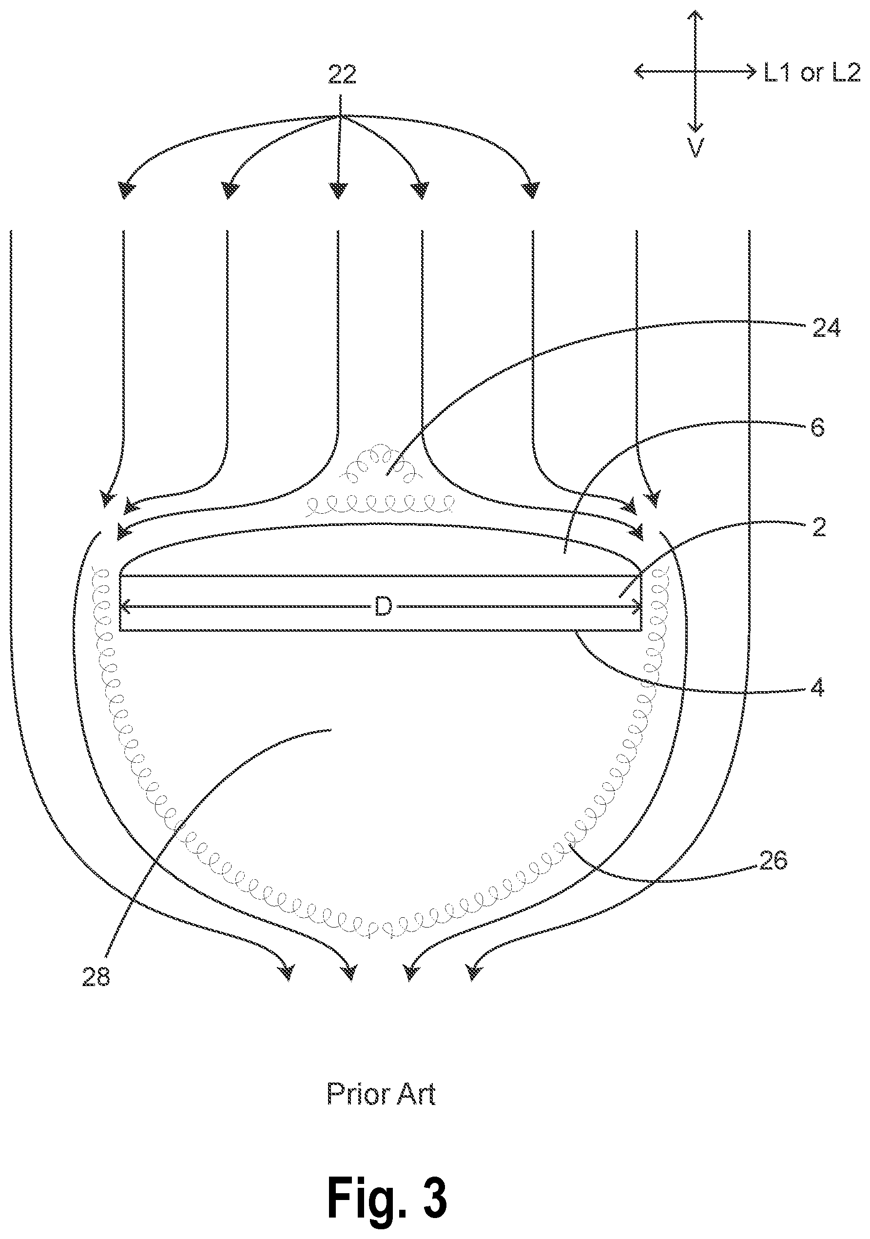 Patent US11774076 Figure 3 – Aerodynamic surgical light and boom systems