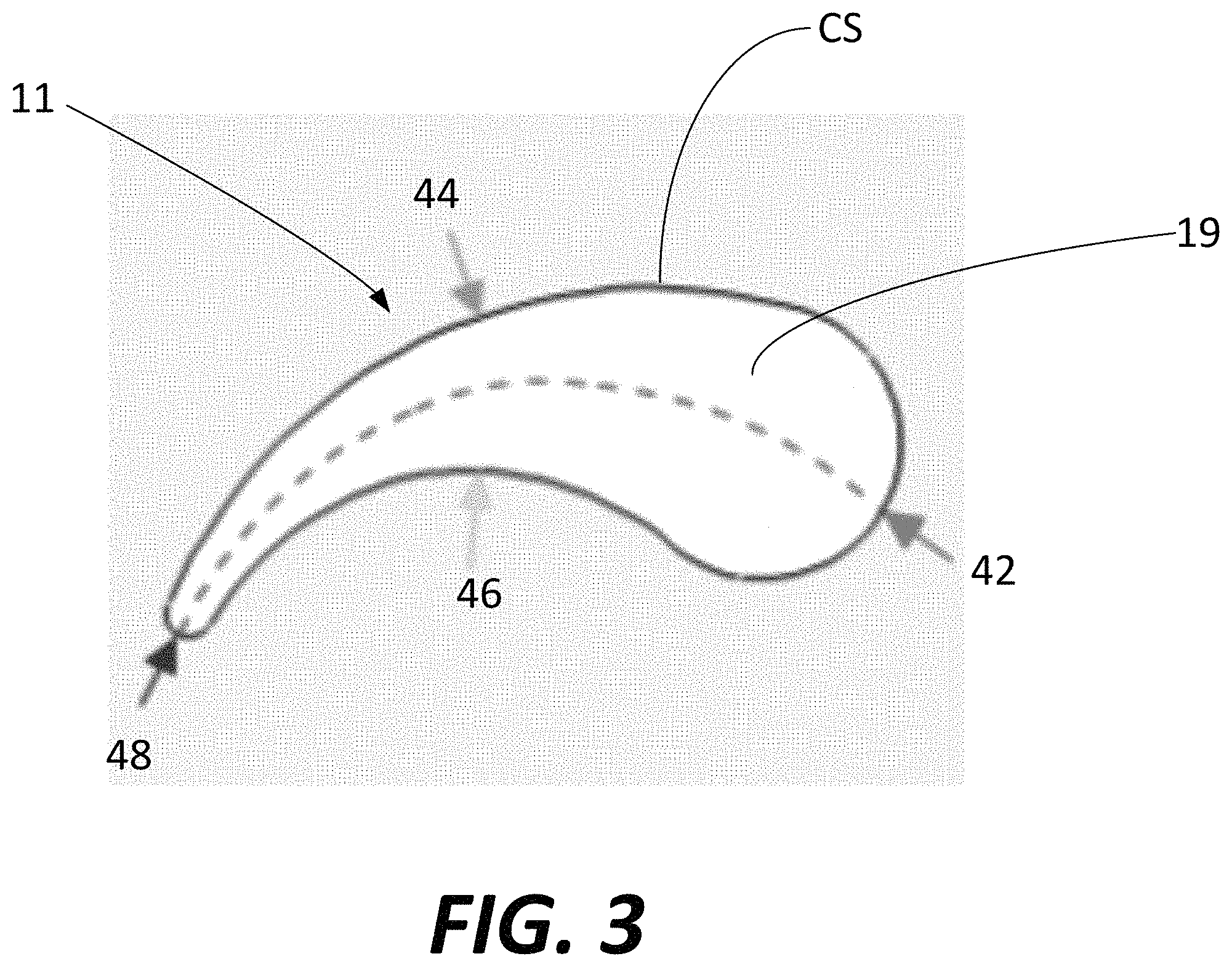Patent US11774226 Figure 4 – Scanning path segmentation of workpiece