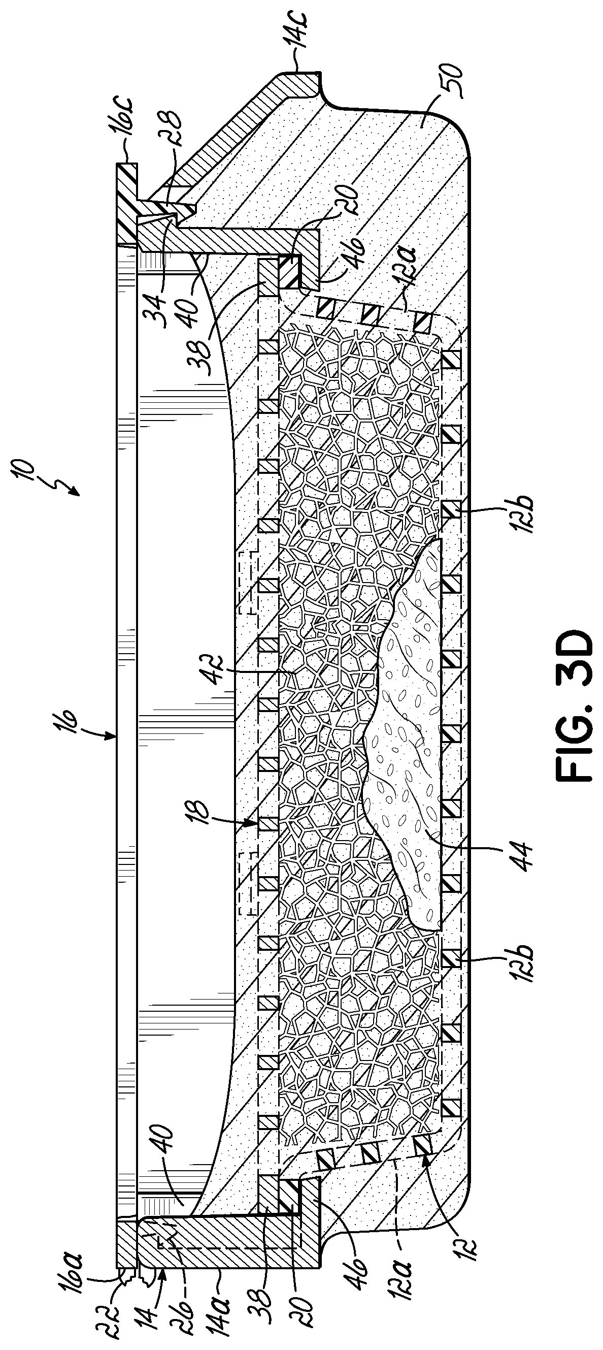 Patent US11774330 Figure 5 – Sectionable cassette and embedding frame with tissue immobilizing separable lid, and methods for preparing biopsy tissue samples