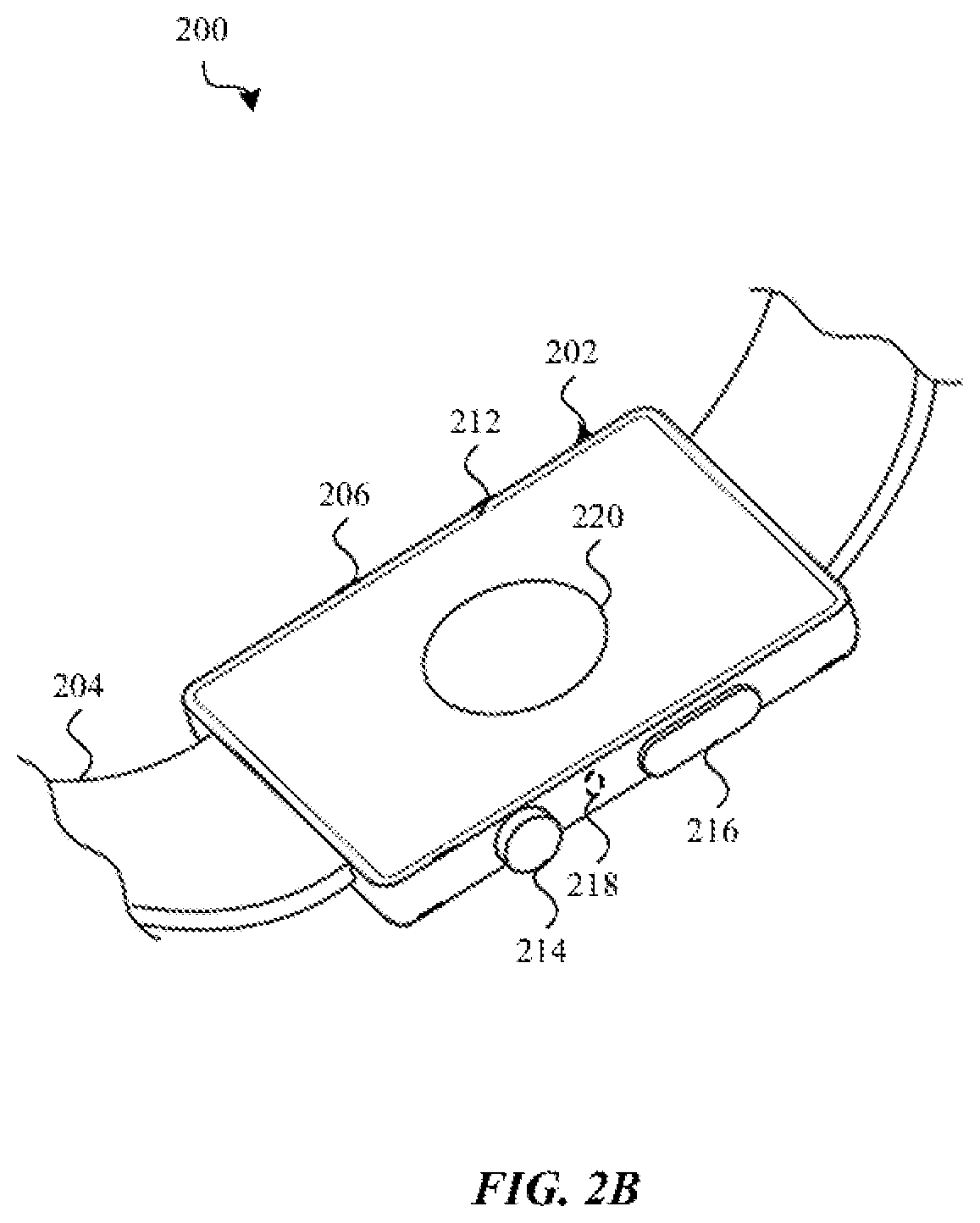 Patent US11774342 Figure 4 – Particulate matter sensors based on split beam self-mixing interferometry sensors
