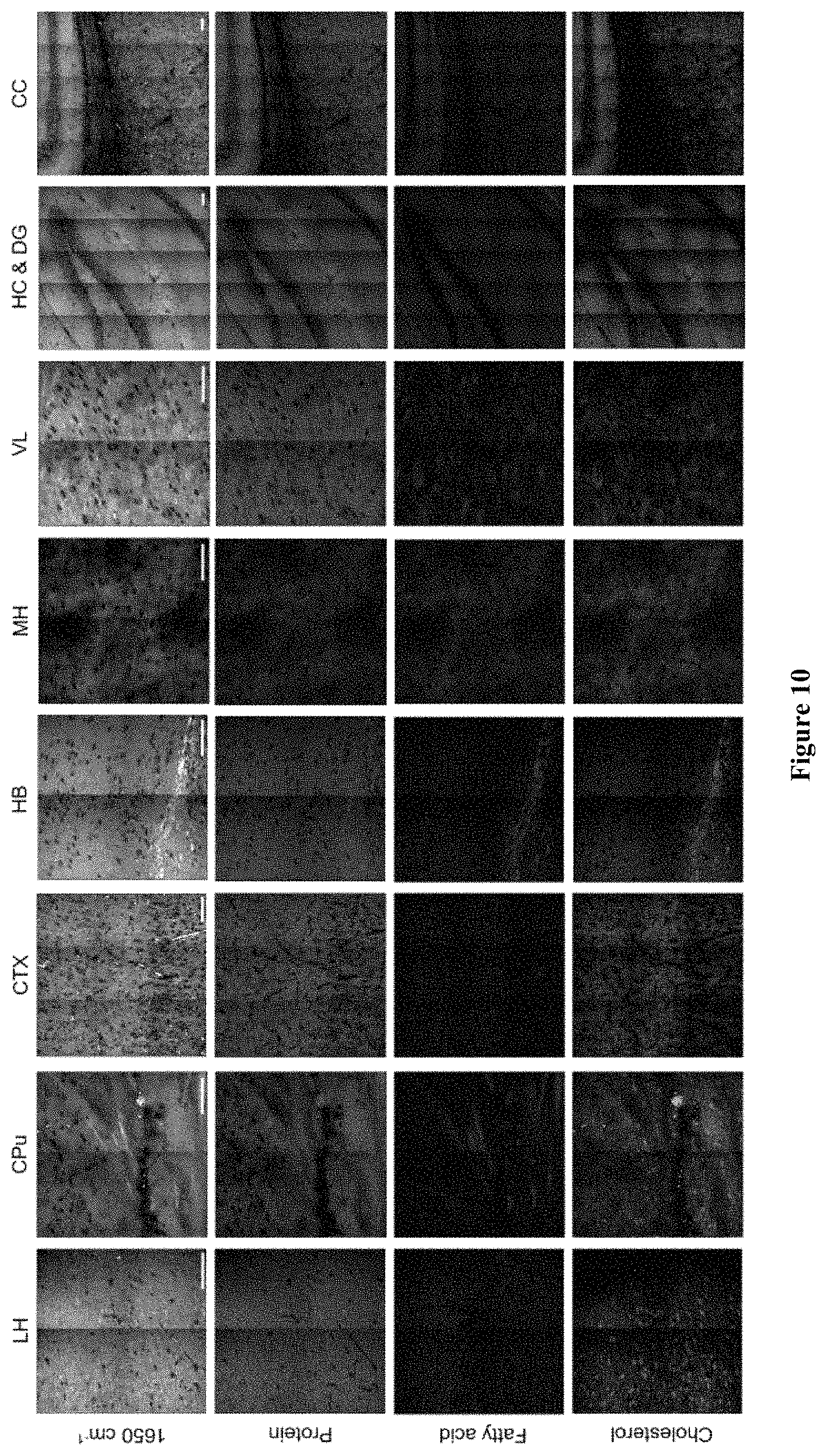 Patent US11774365 Figure 8 – High-speed delay scanning and deep learning techniques for spectroscopic SRS imaging