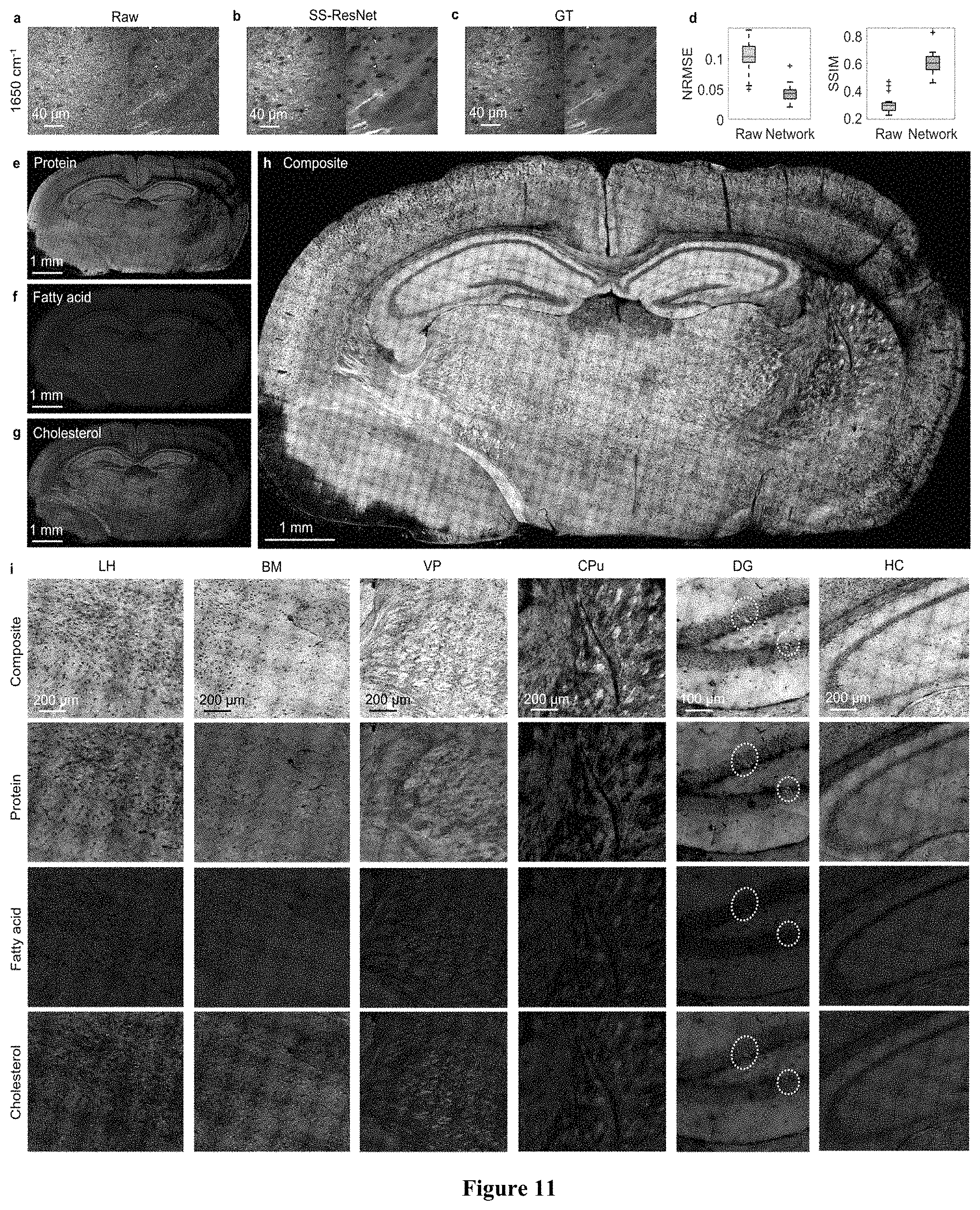 Patent US11774365 Figure 9 – High-speed delay scanning and deep learning techniques for spectroscopic SRS imaging