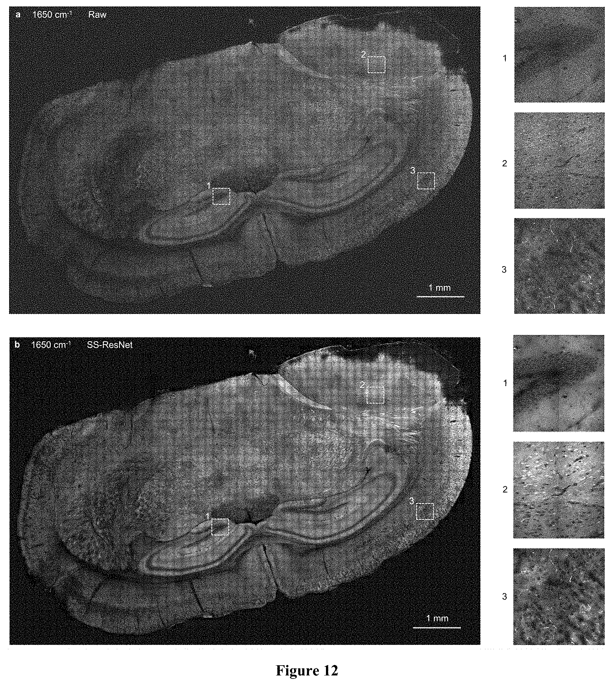 Patent US11774365 Figure 10 – High-speed delay scanning and deep learning techniques for spectroscopic SRS imaging