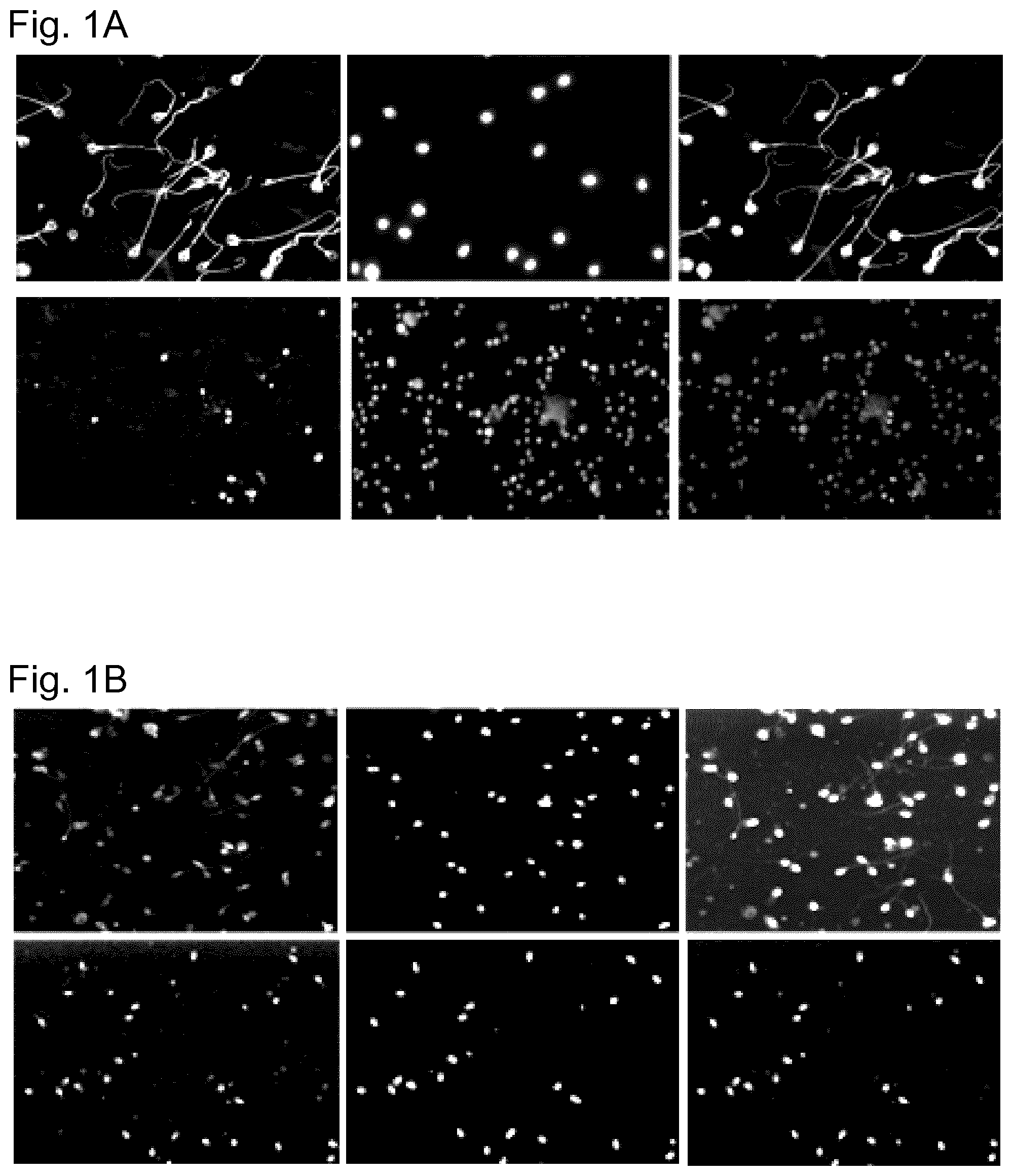 Patent US11774441 Figure 1 – Method for determining the fertility of spermatozoa comprising detection of vimentin variant 3