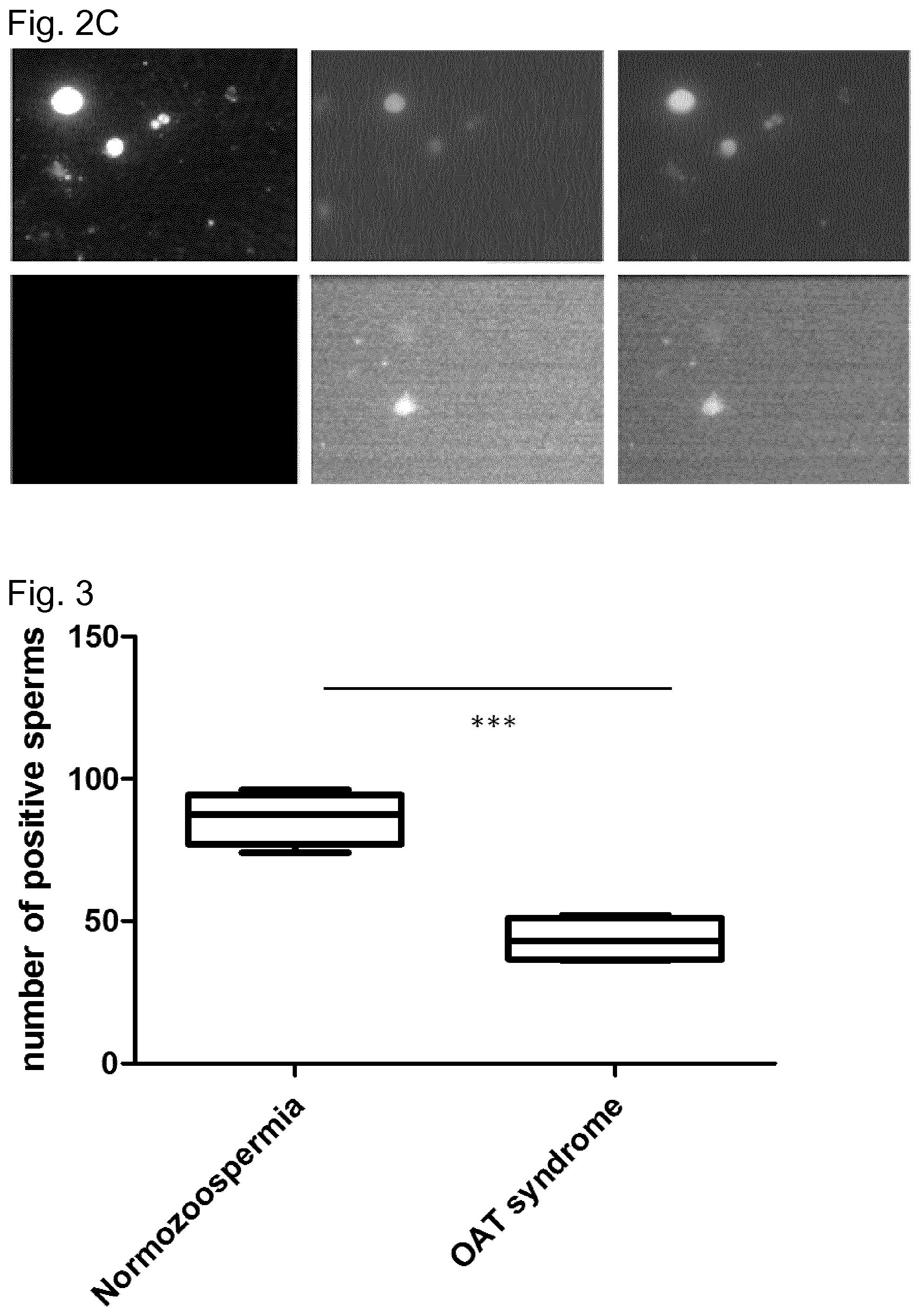 Patent US11774441 Figure 3 – Method for determining the fertility of spermatozoa comprising detection of vimentin variant 3