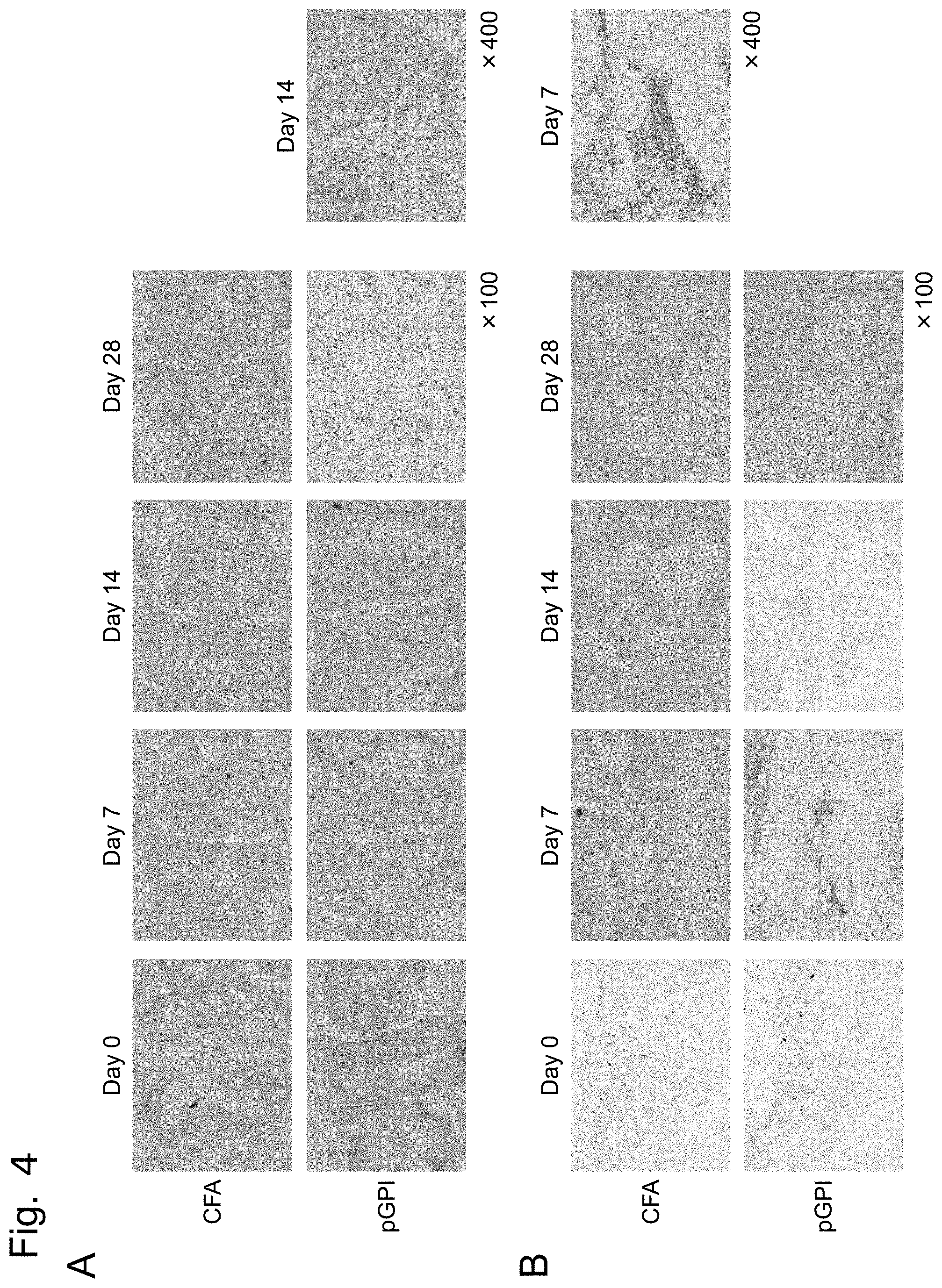 Patent US11774447 Figure 4 – Detection of citrullinated inter-alpha-trypsin inhibitor heavy chain 4 (ITIH4)