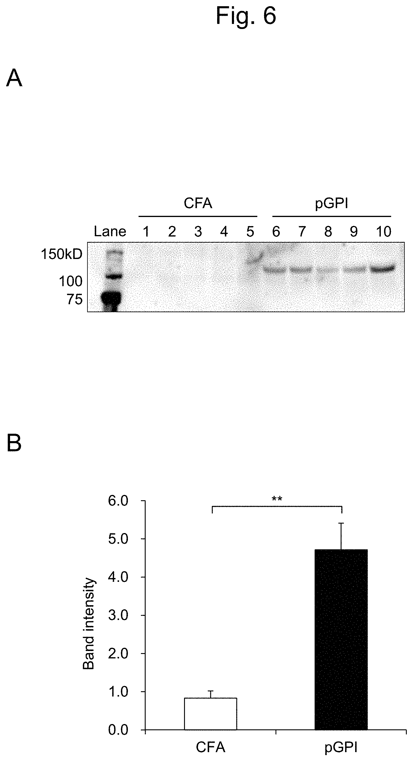 Patent US11774447 Figure 6 – Detection of citrullinated inter-alpha-trypsin inhibitor heavy chain 4 (ITIH4)