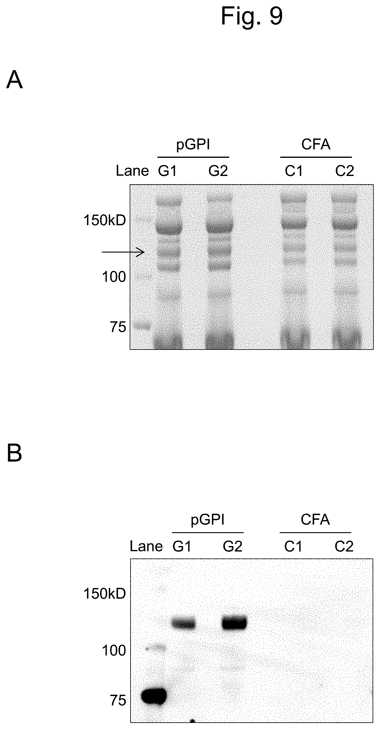 Patent US11774447 Figure 9 – Detection of citrullinated inter-alpha-trypsin inhibitor heavy chain 4 (ITIH4)