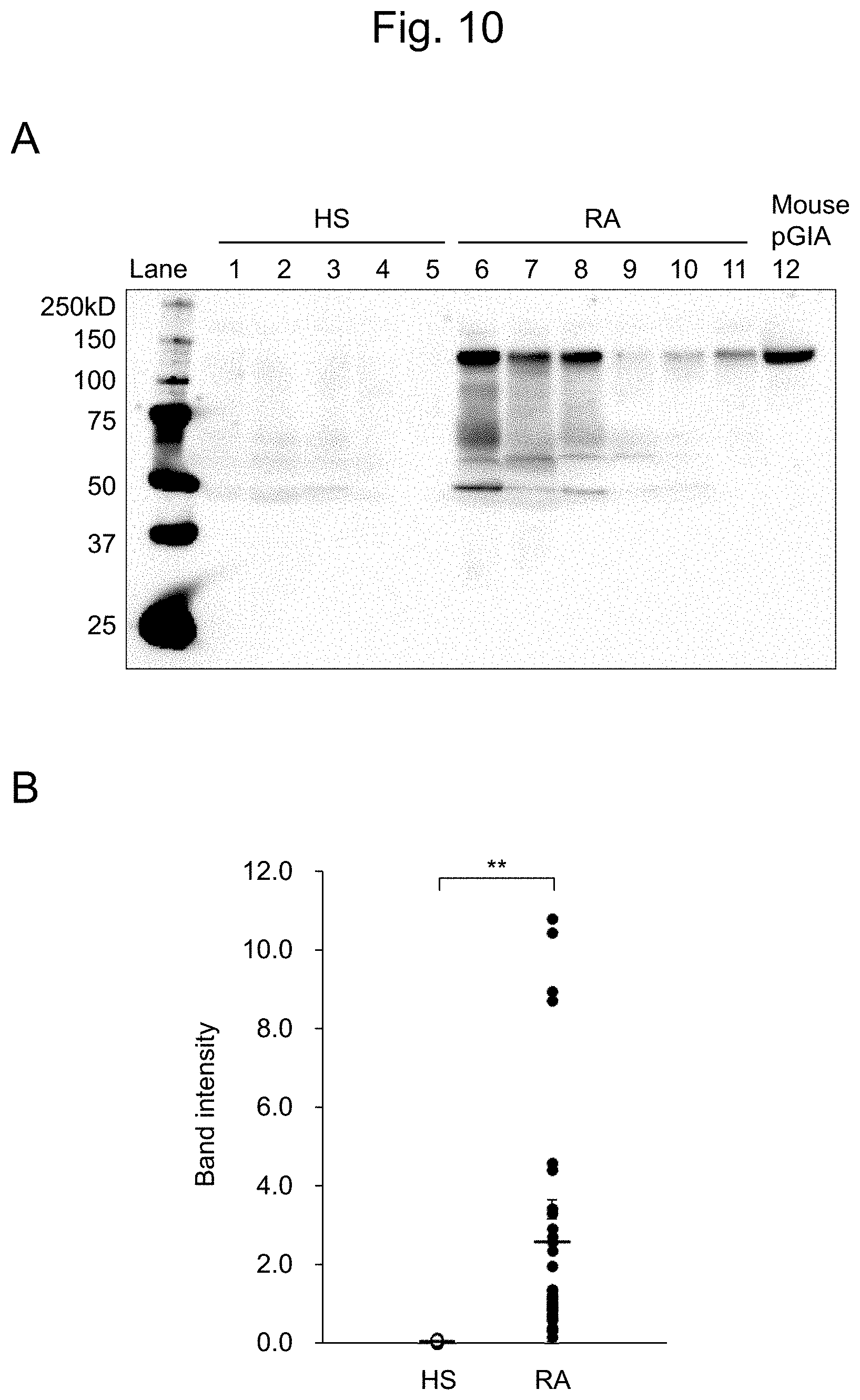 Patent US11774447 Figure 10 – Detection of citrullinated inter-alpha-trypsin inhibitor heavy chain 4 (ITIH4)