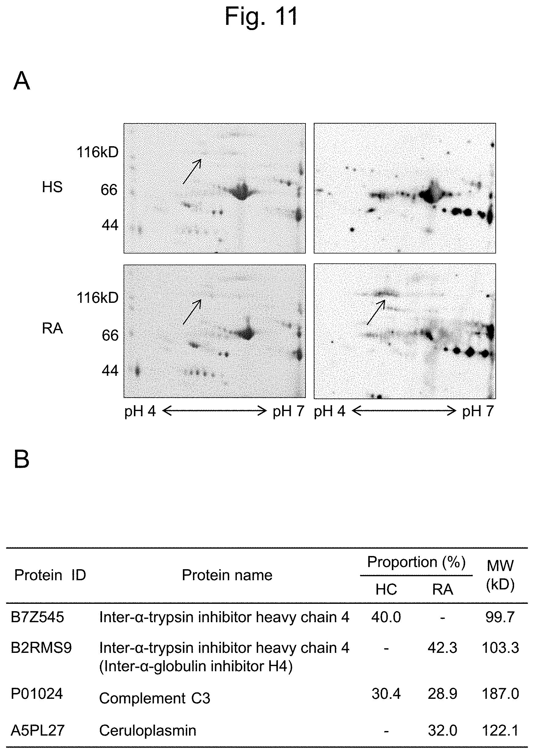 Patent US11774447 Figure 11 – Detection of citrullinated inter-alpha-trypsin inhibitor heavy chain 4 (ITIH4)