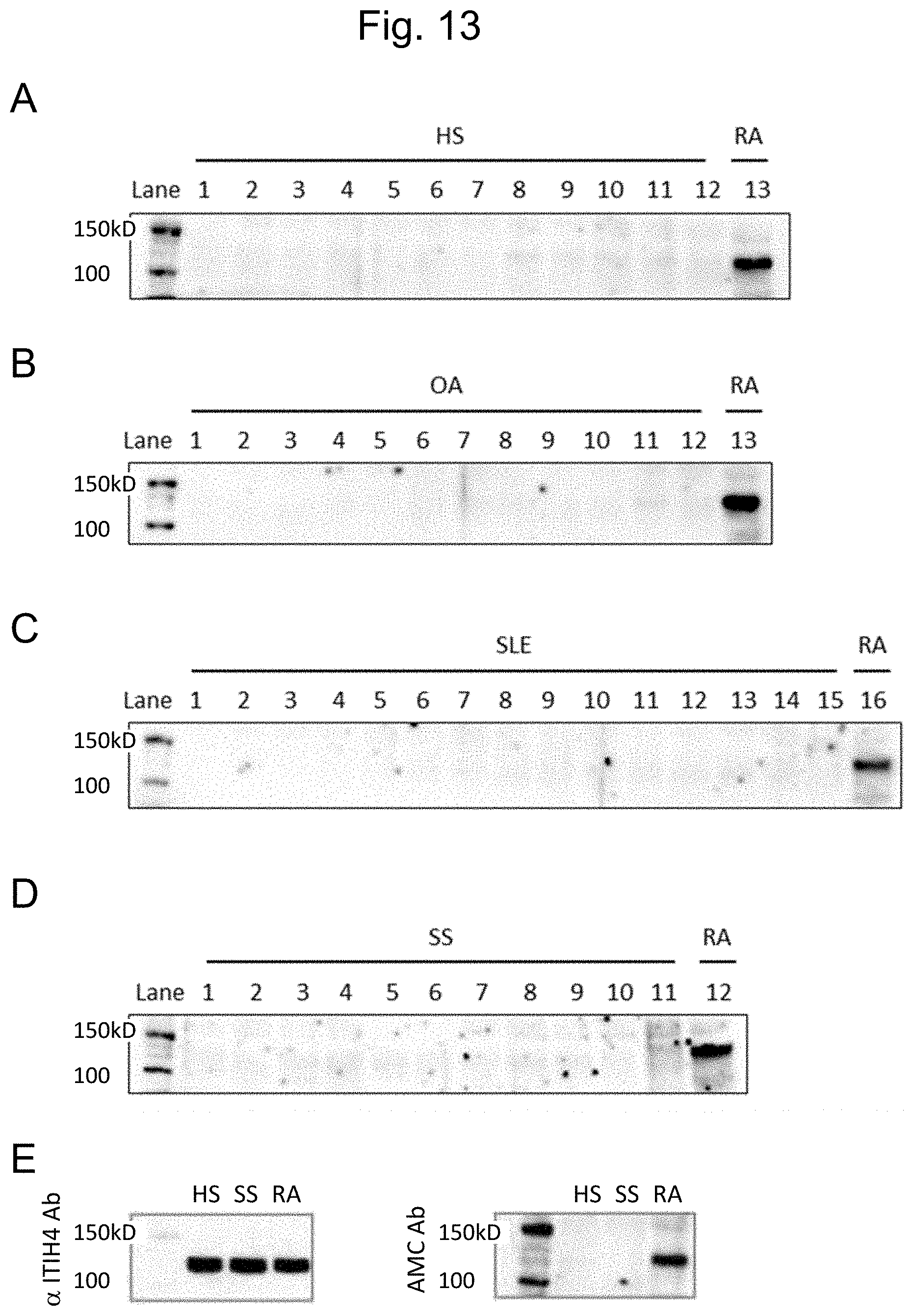 Patent US11774447 Figure 13 – Detection of citrullinated inter-alpha-trypsin inhibitor heavy chain 4 (ITIH4)
