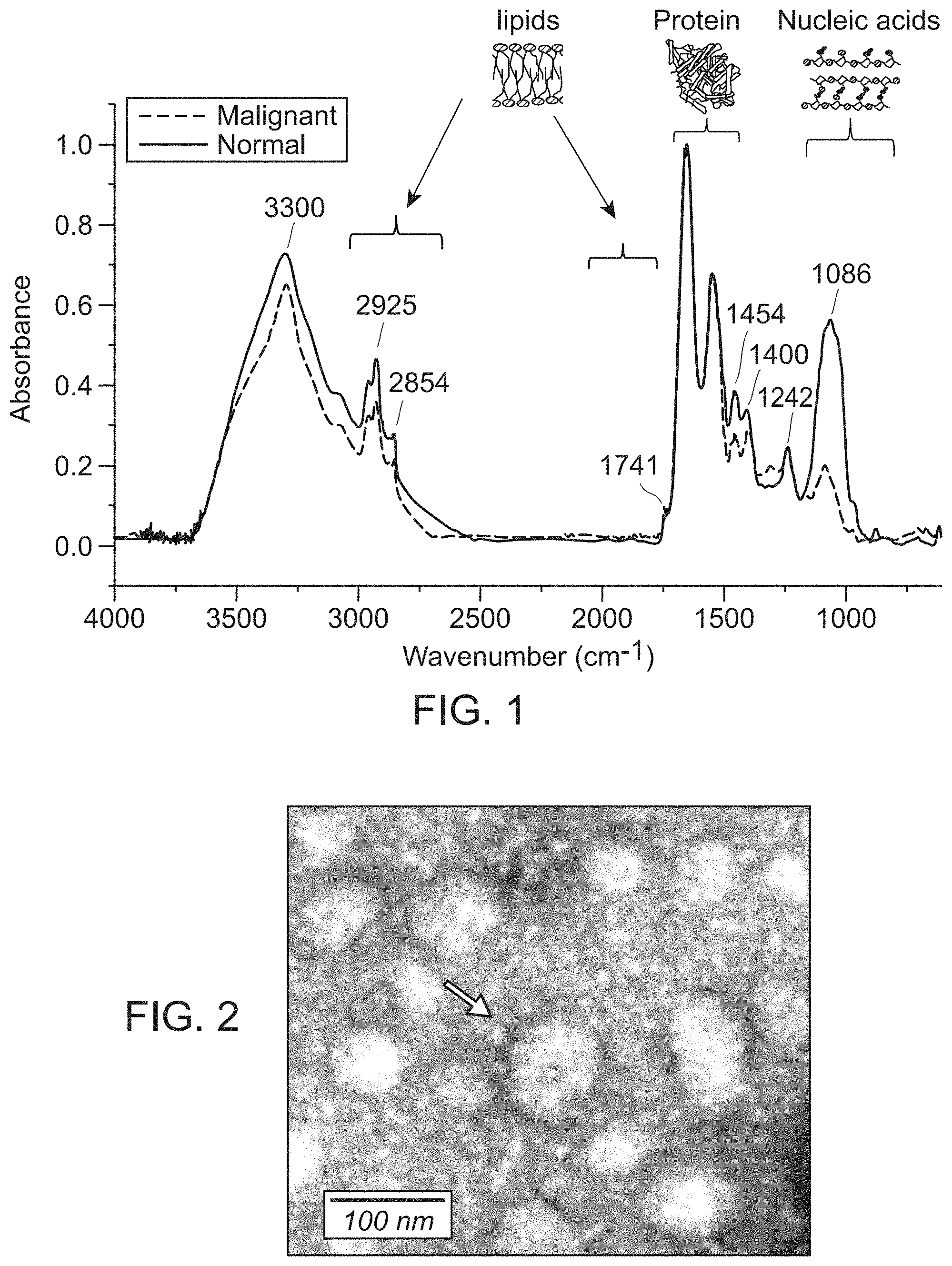 Patent US11774451 Figure 1 – Molecular vibrational spectroscopic markers for detection of cancer