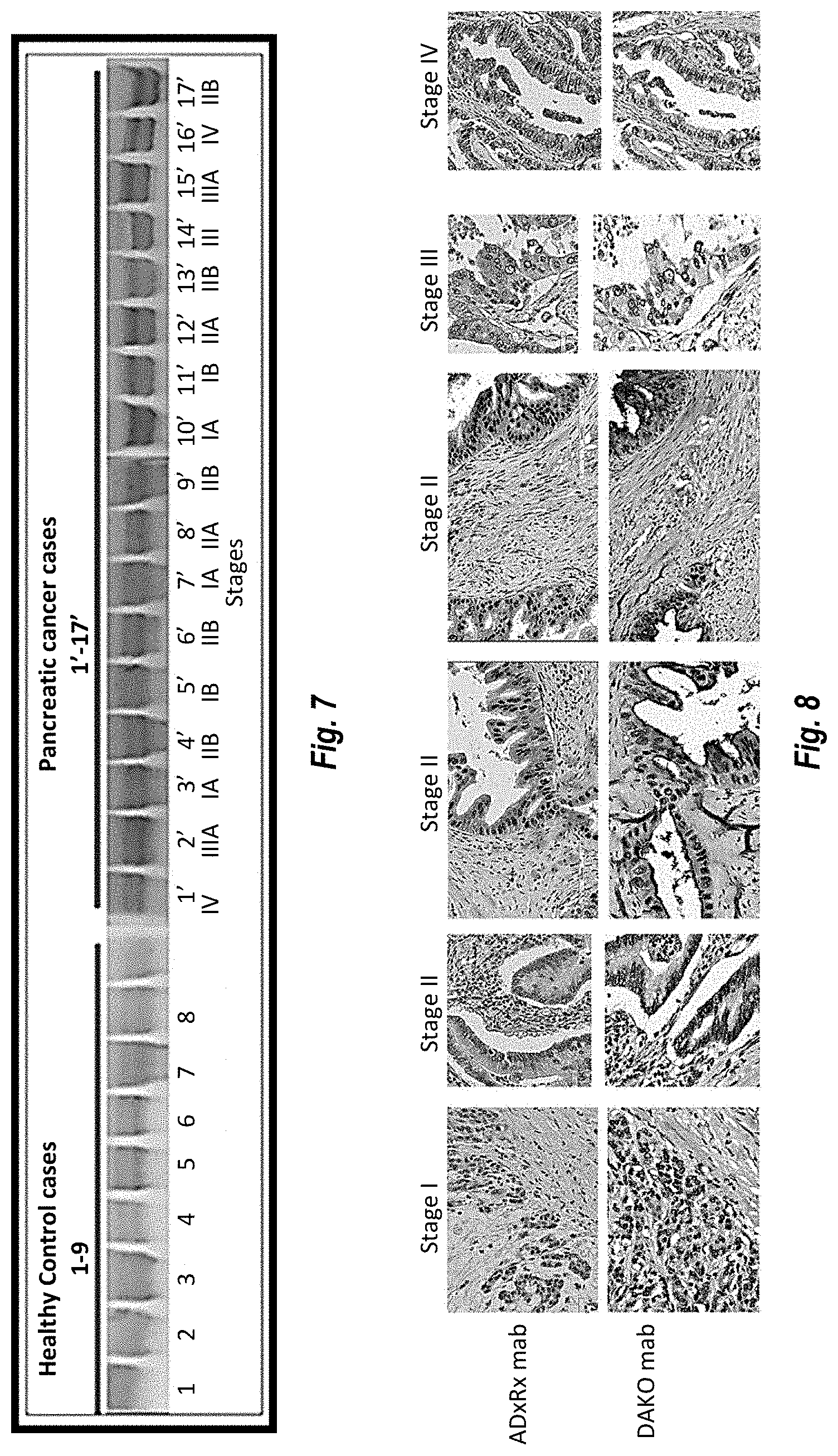 Patent US11774452 Figure 6 – Antibodies against carcinoembryonic antigens