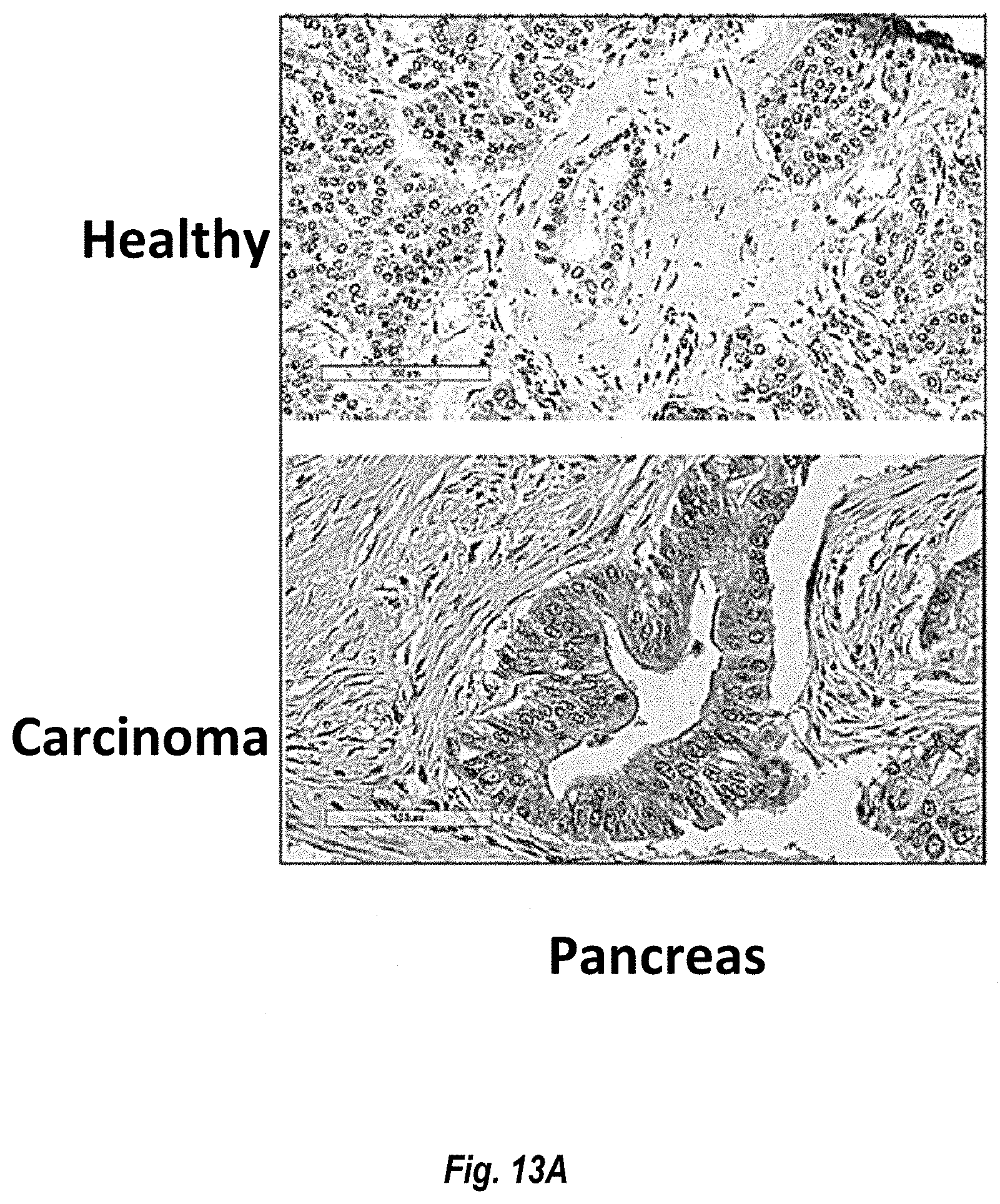 Patent US11774452 Figure 12 – Antibodies against carcinoembryonic antigens