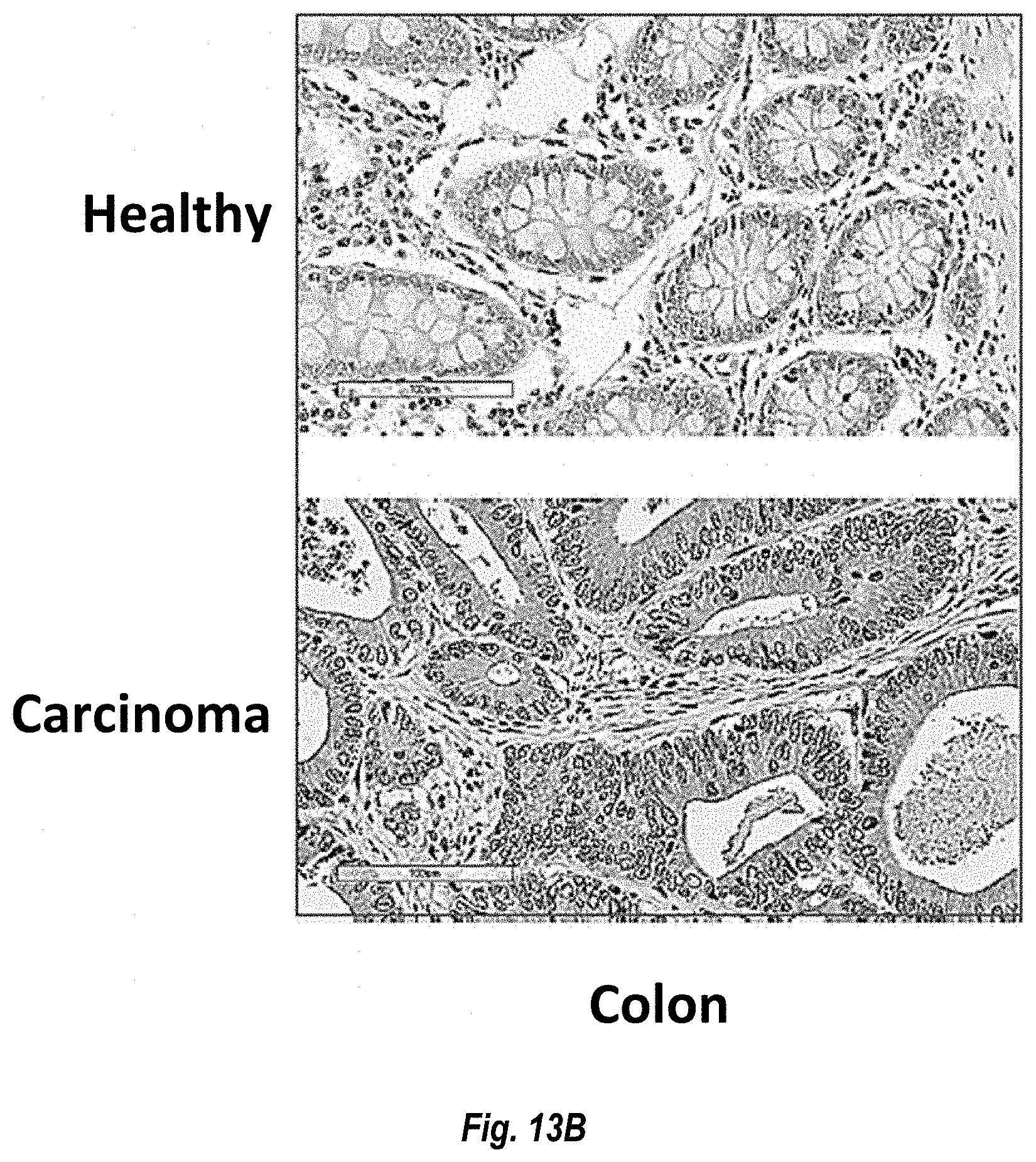 Patent US11774452 Figure 13 – Antibodies against carcinoembryonic antigens