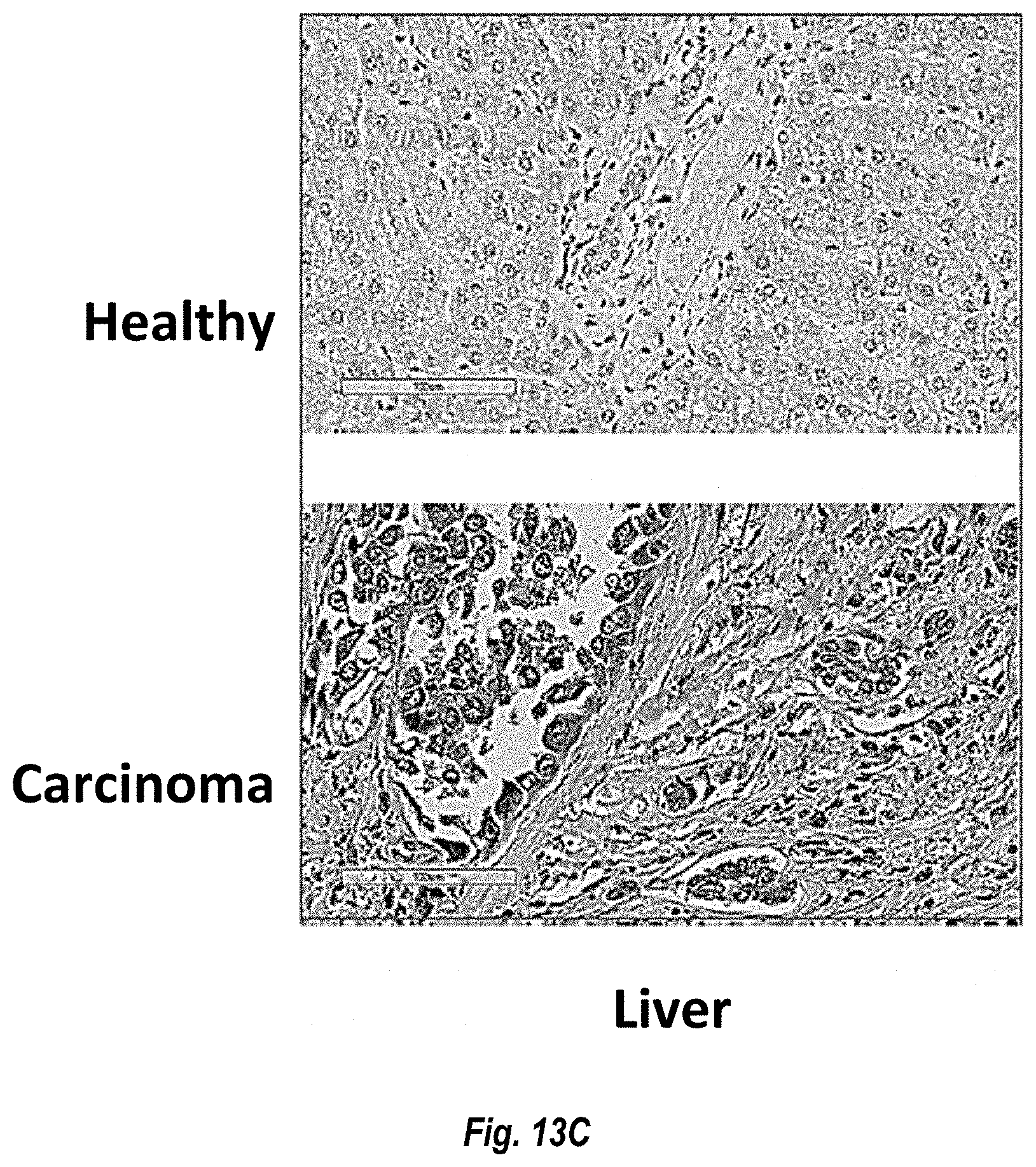 Patent US11774452 Figure 14 – Antibodies against carcinoembryonic antigens