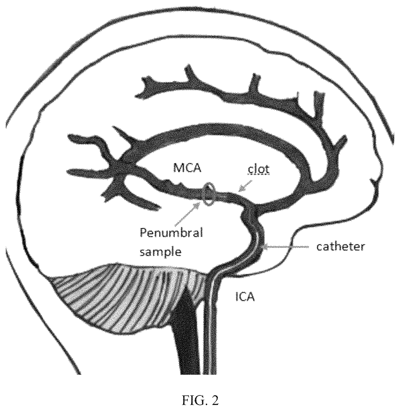 Patent US11774457 Figure 8 – Identification and analysis of protein biomarkers