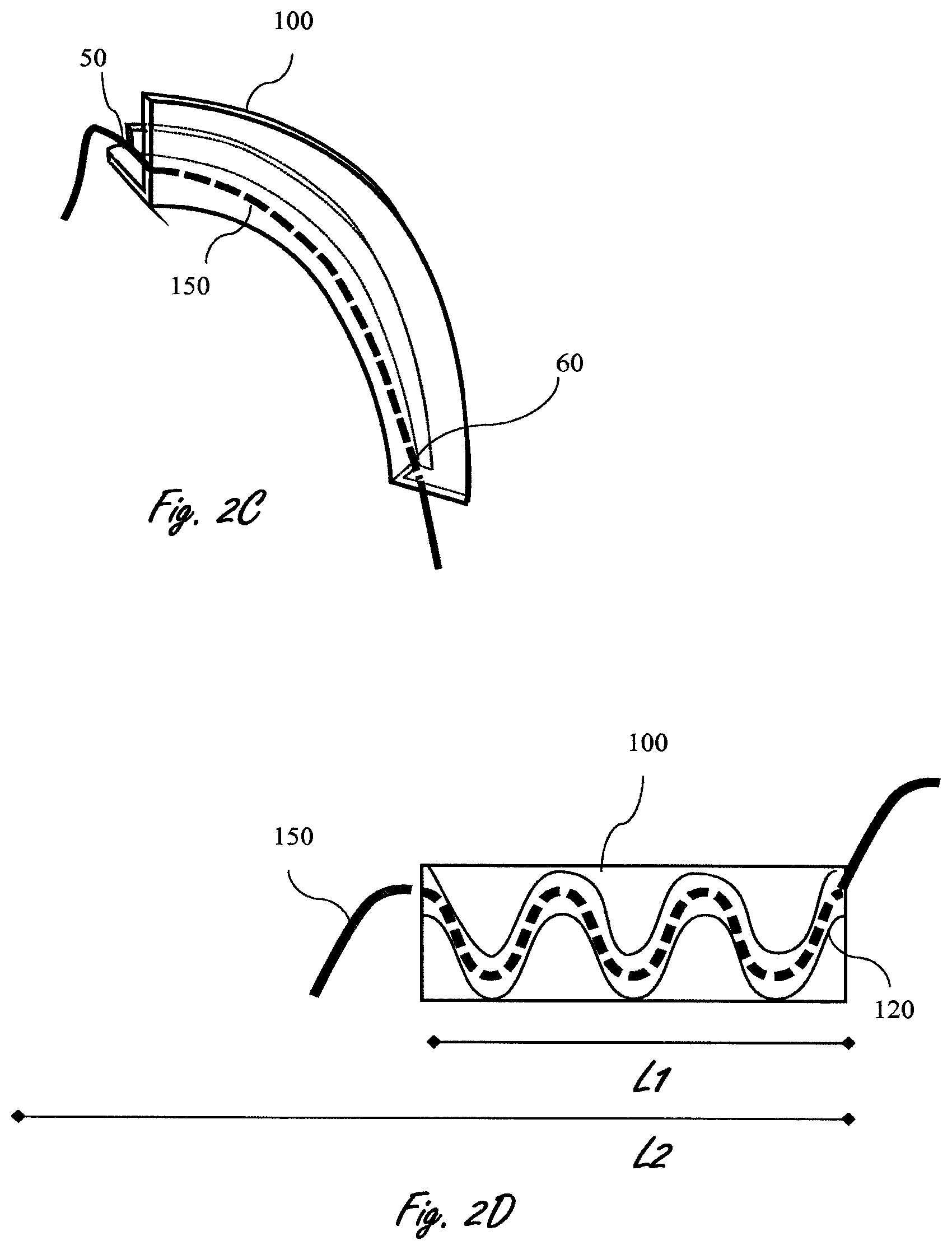 Patent US11774532 Figure 4 – Rf shielding conduit in an mri closure assembly