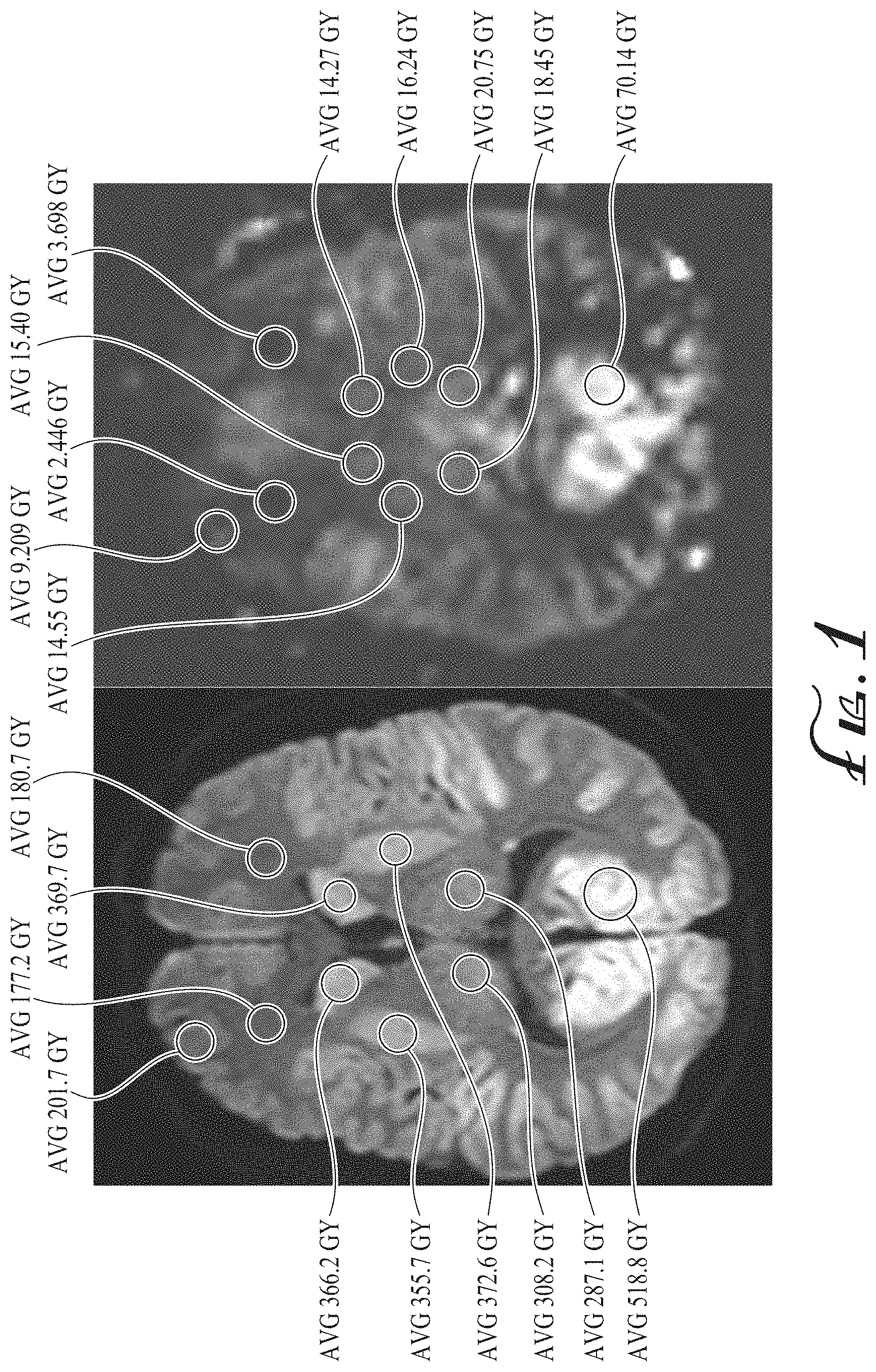 Patent US11774536 — Imaging biomarkers based on ratio between diffusion and perfusion — Figure 1