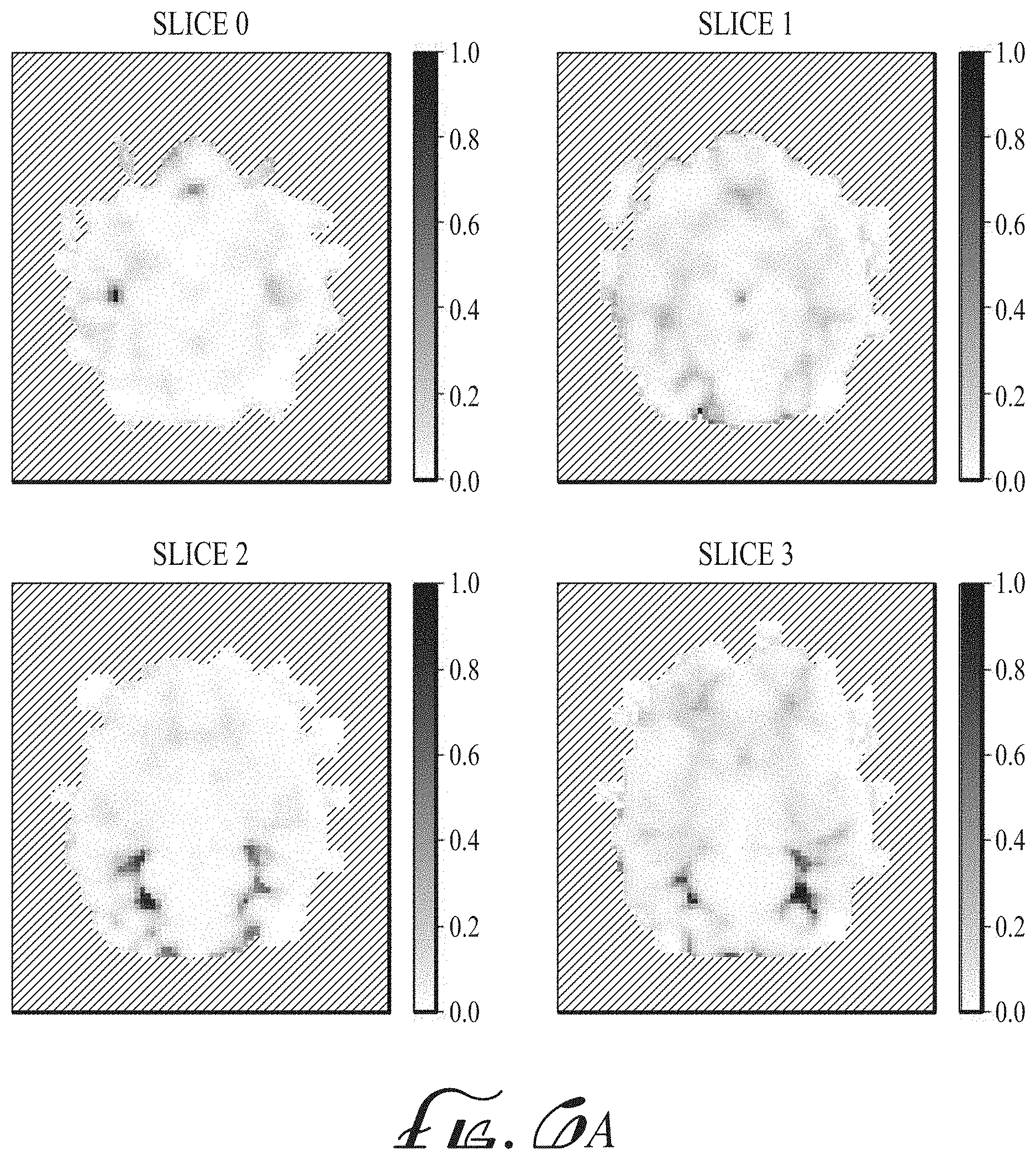 Patent US11774536 Figure 6 – Imaging biomarkers based on ratio between diffusion and perfusion